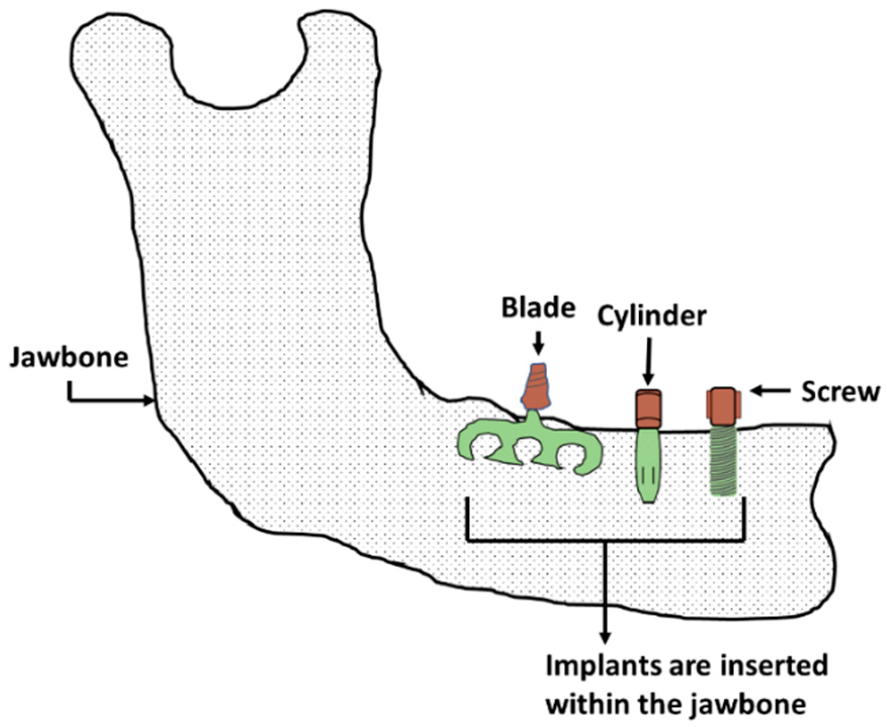 Materials 16 00161 g004 Materials 16 00161 g004
