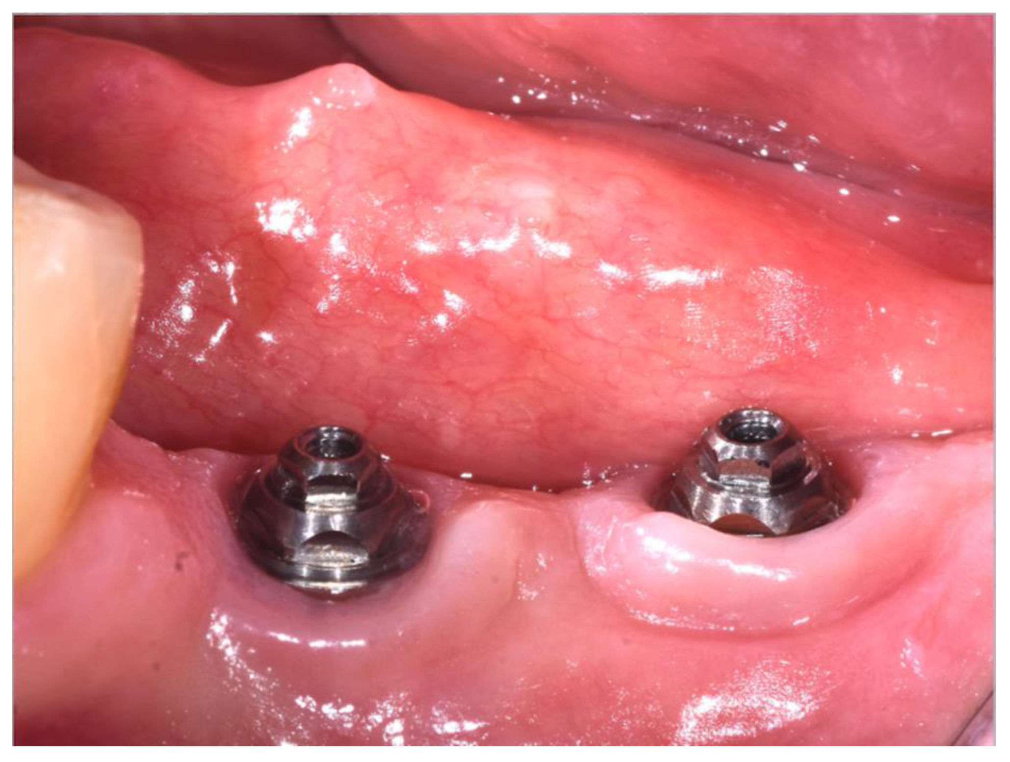 Materials 16 00246 g004 Materials 16 00246 g004