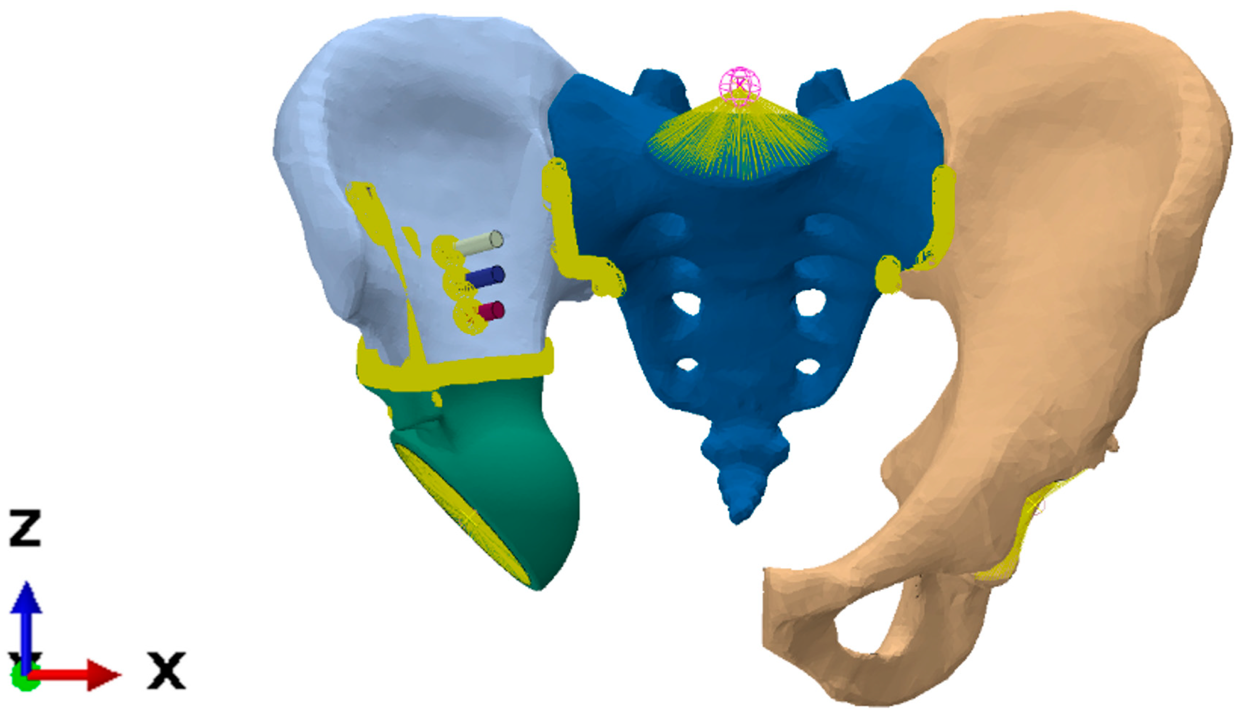 Materials 16 00398 g011