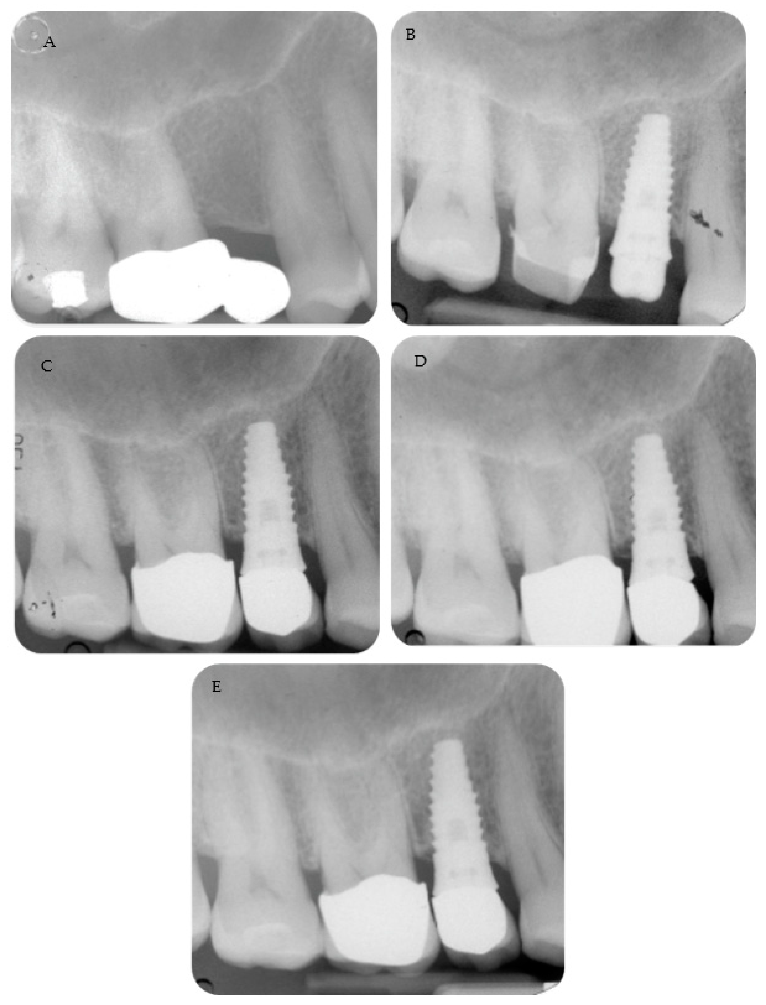 Materials 16 01293 g002 550