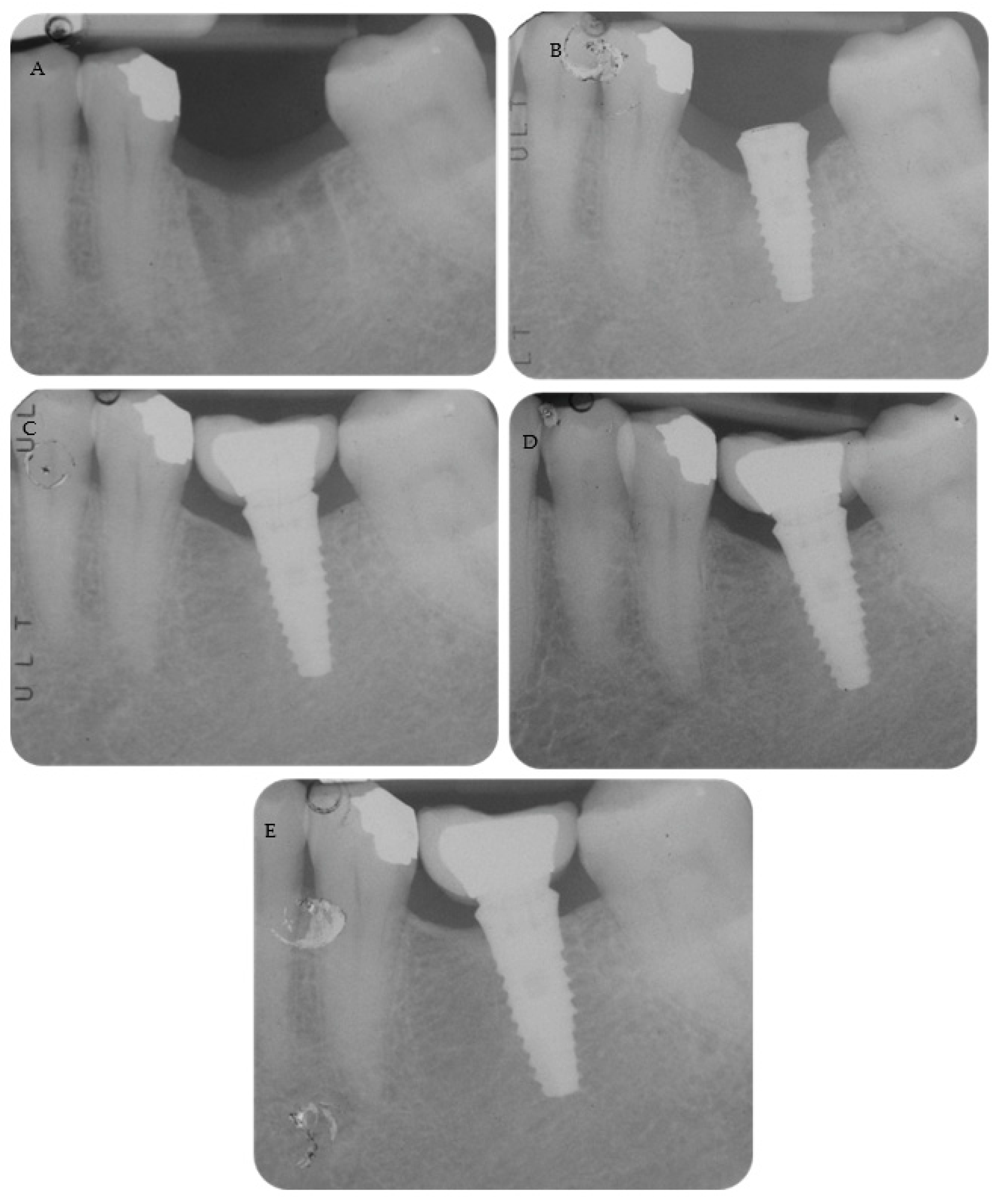 Materials 16 01293 g003 550