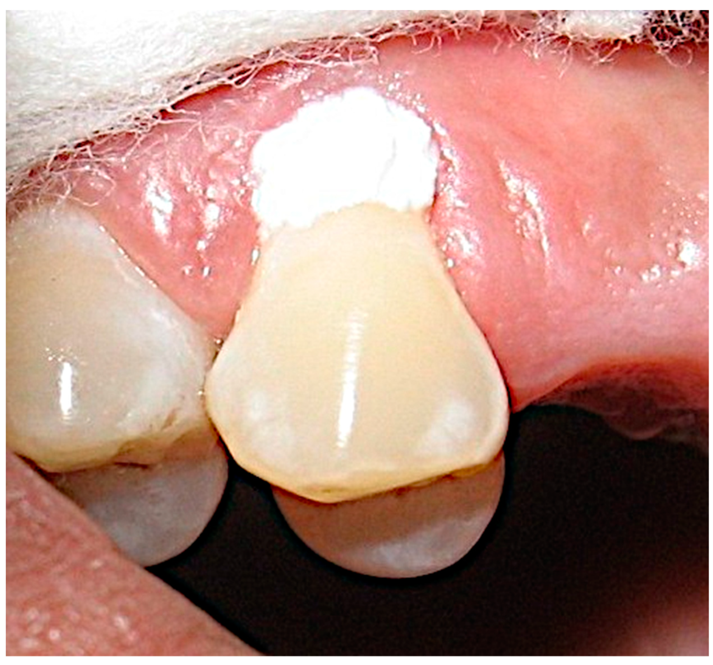 Materials 16 01329 g004