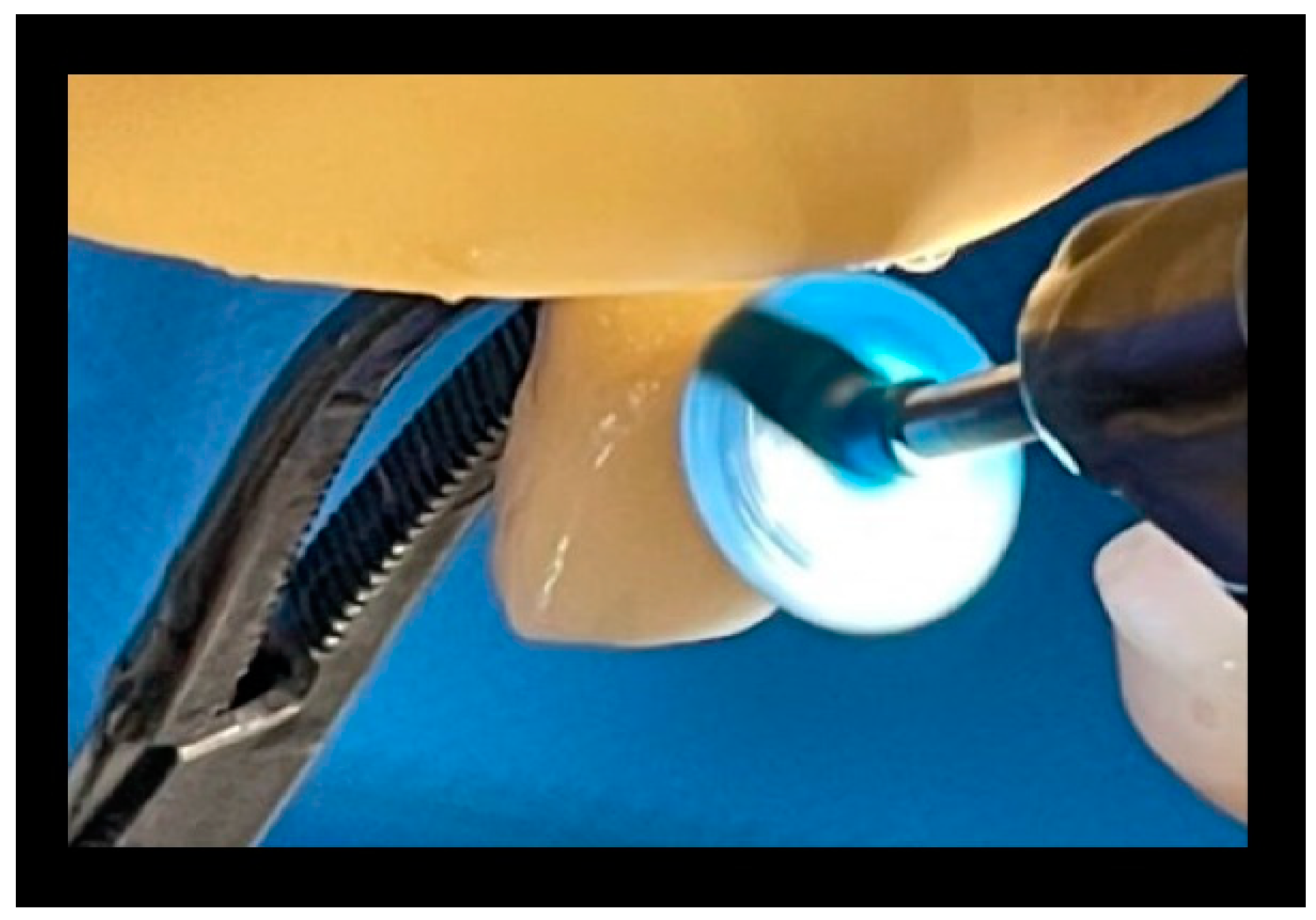 Materials 16 01373 g015