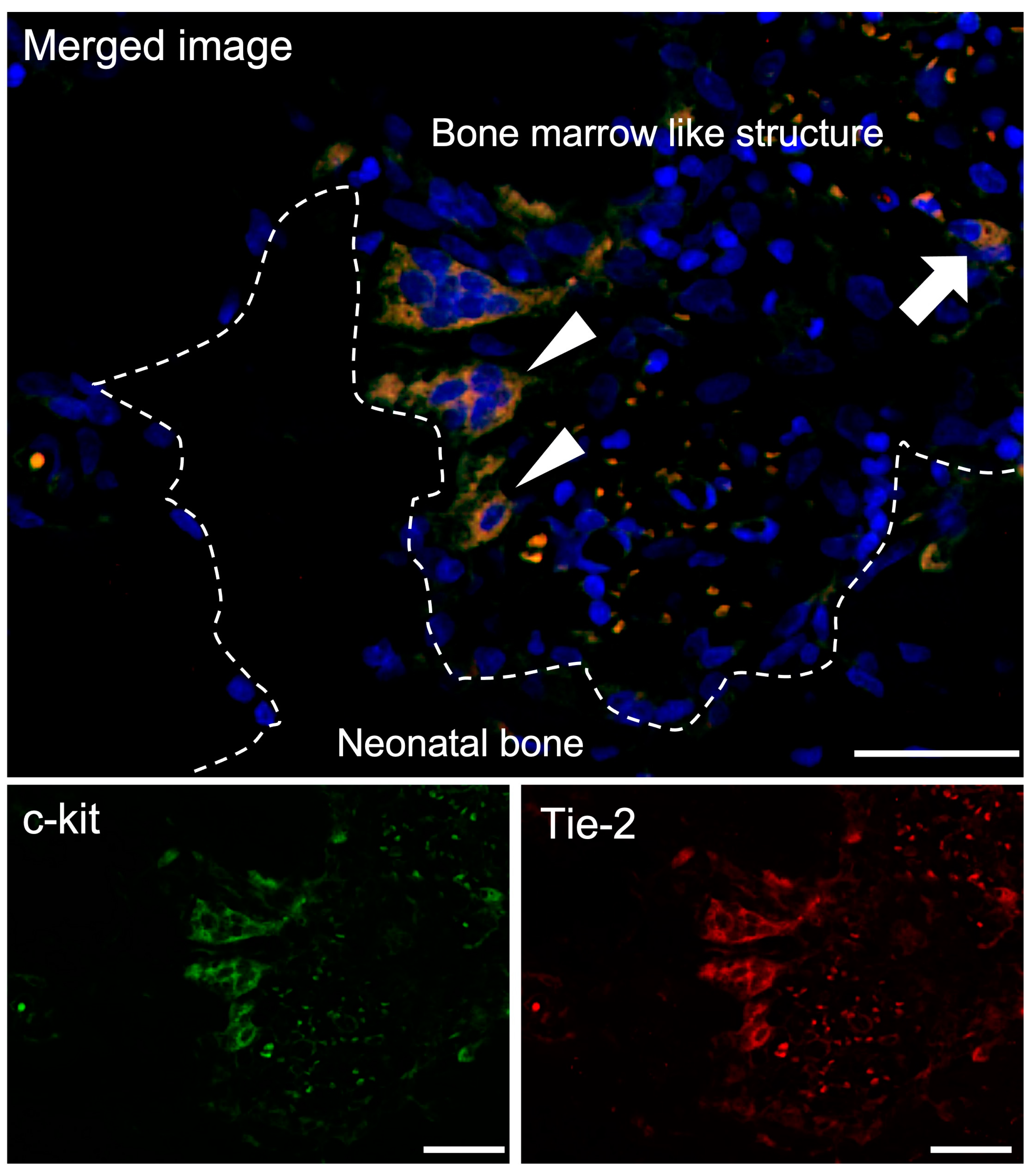 Materials 16 01393 g005