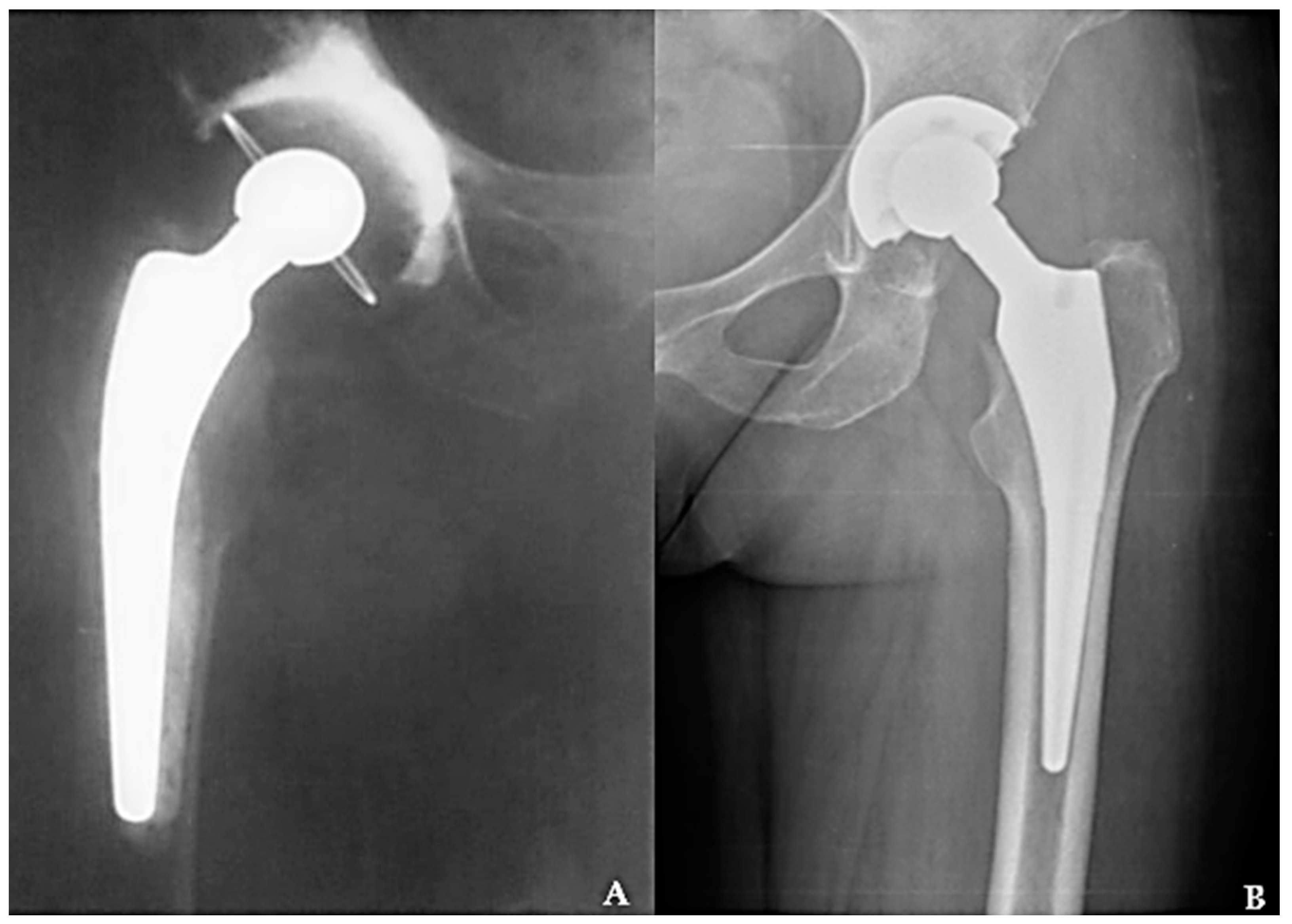 Materials 16 01640 g002