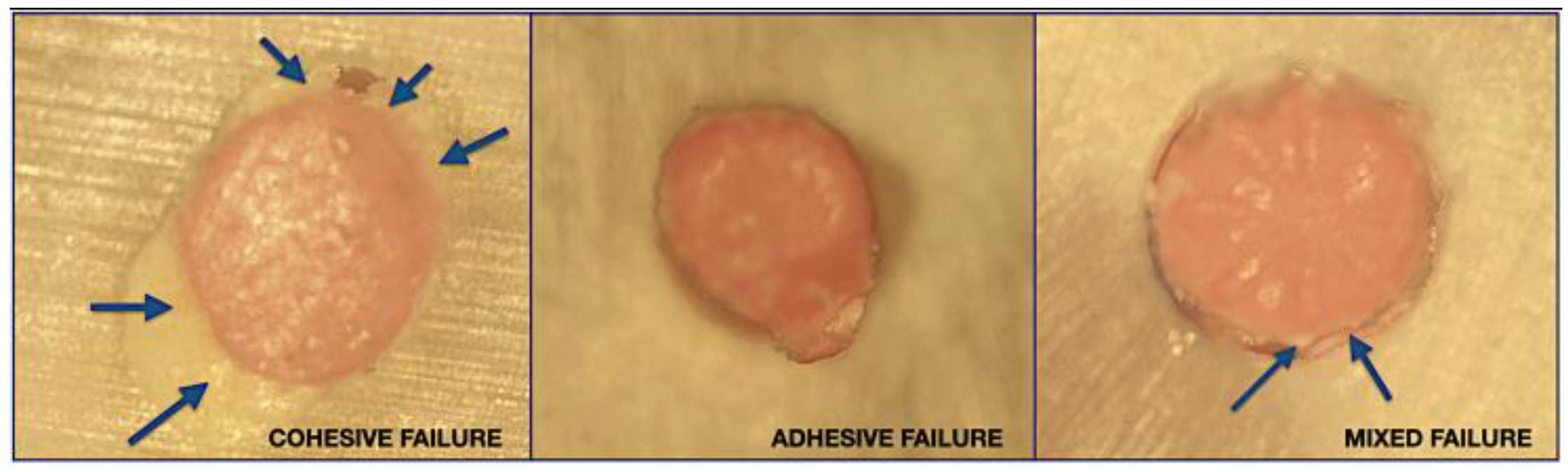 Materials 16 01761 g002 Materials 16 01761 g002