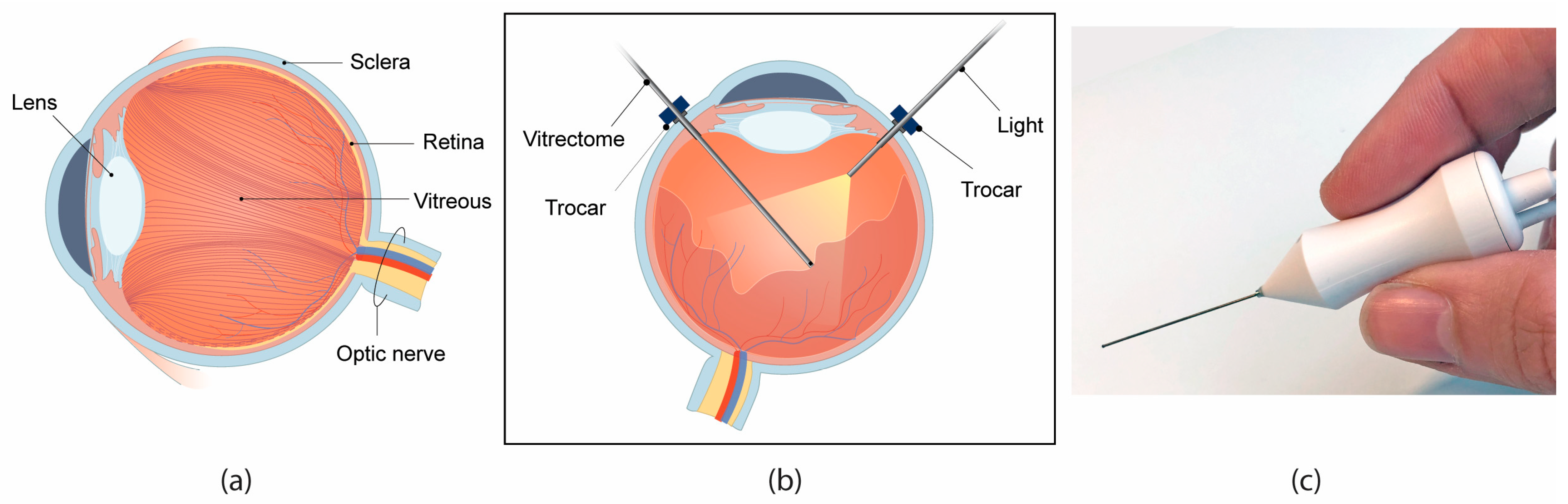Materials 16 01772 g001 Materials 16 01772 g001