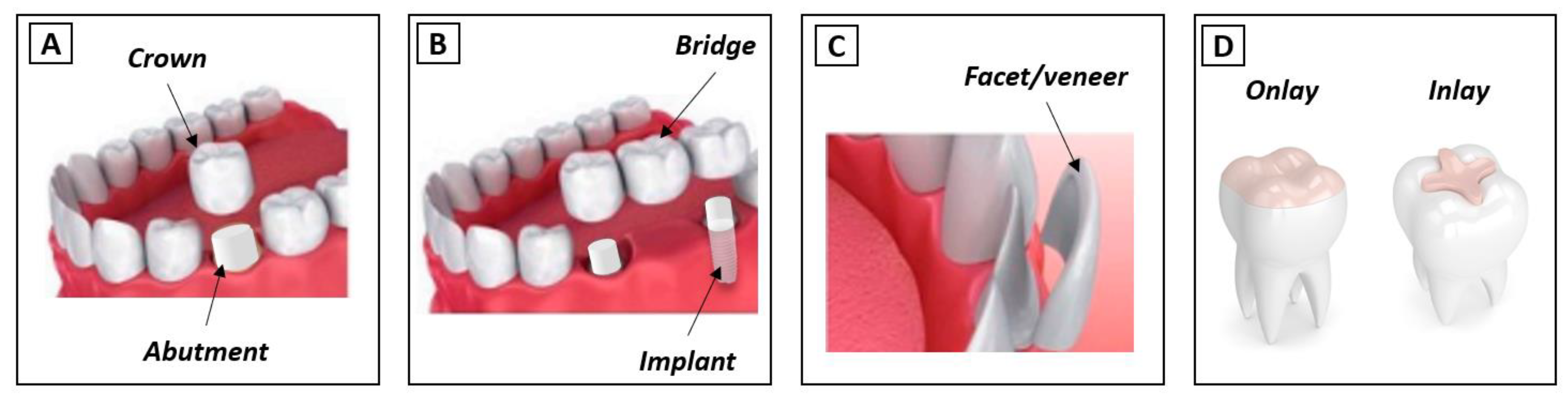Materials Free FullText Recent Advances on 3DPrinted Zirconia