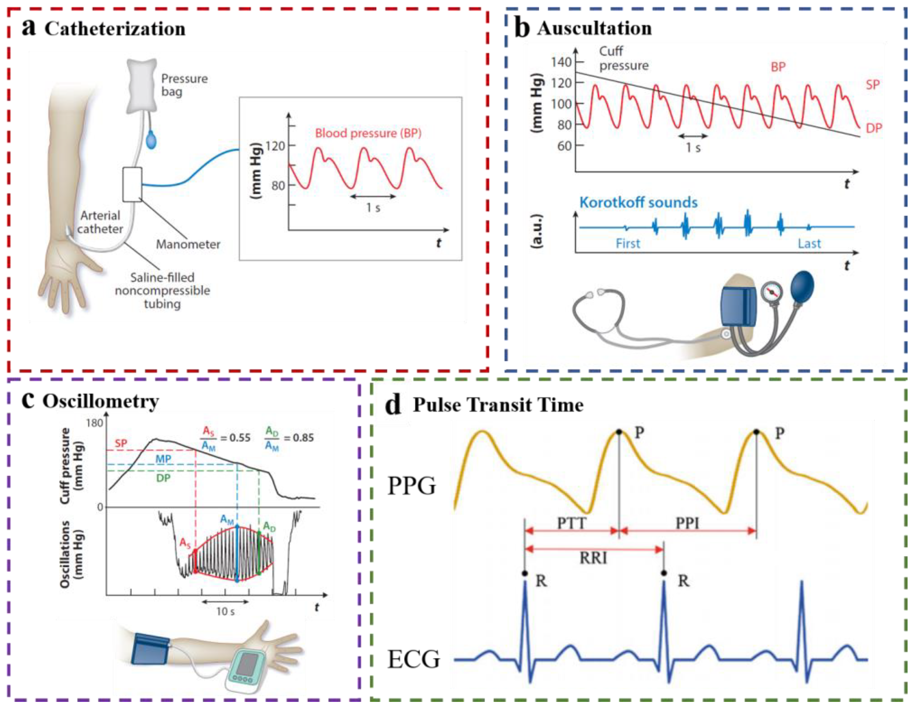 Ambulatory Blood Pressure Monitoring in Children and Adolescents: 2022  Update - Professional Heart Daily