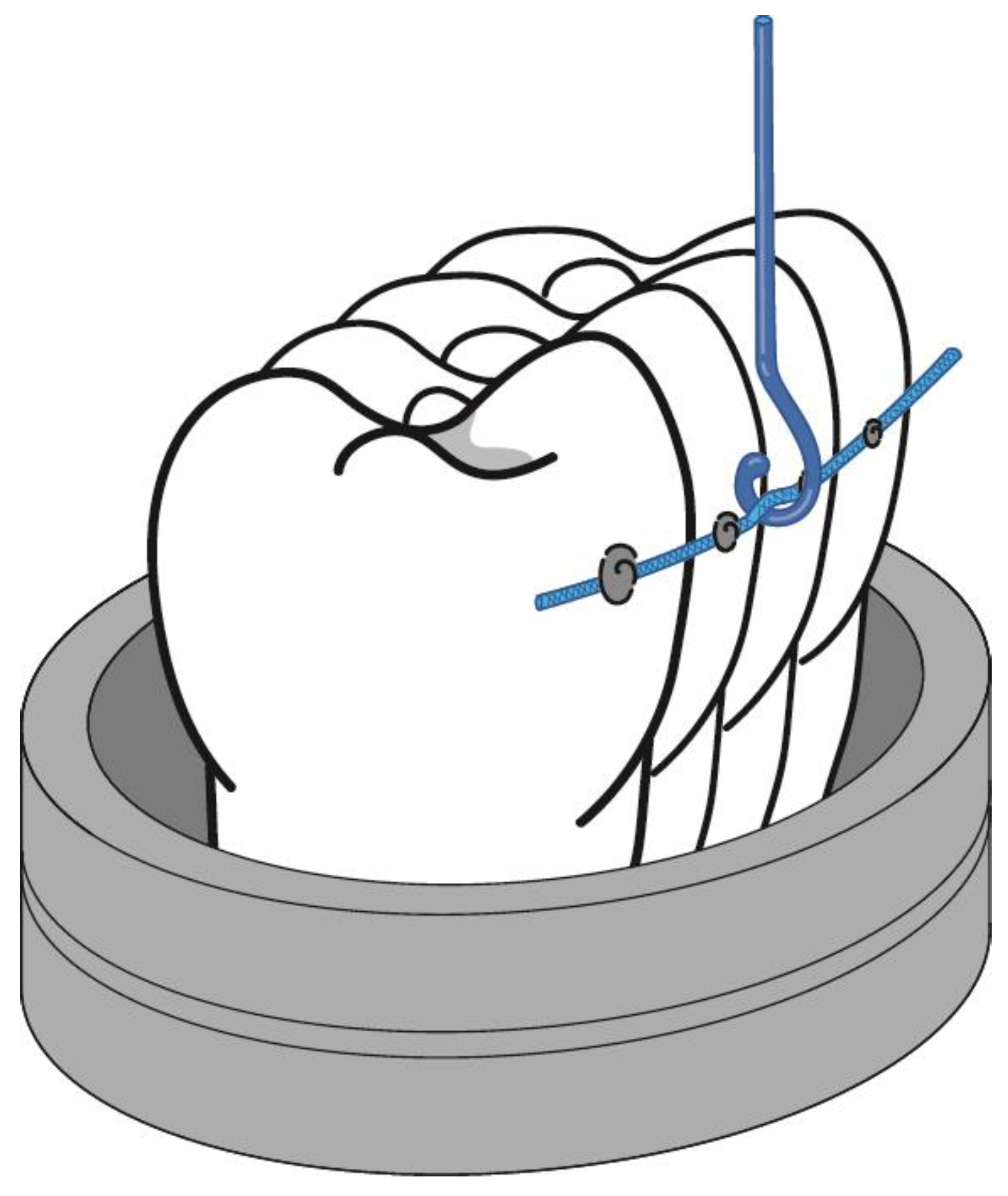 Materials 16 02403 g002 Materials 16 02403 g002