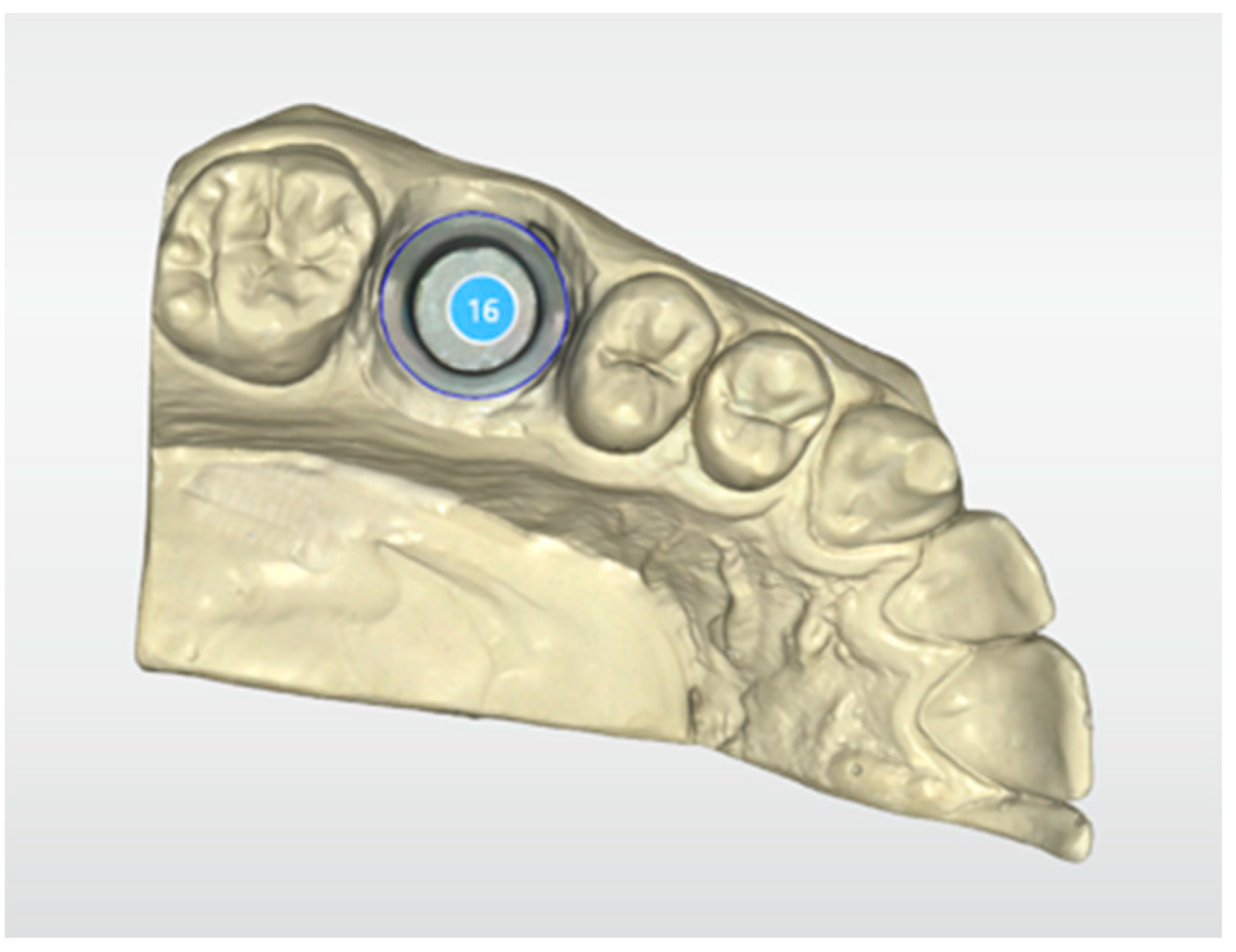 Materials 16 02413 g002 Materials 16 02413 g002