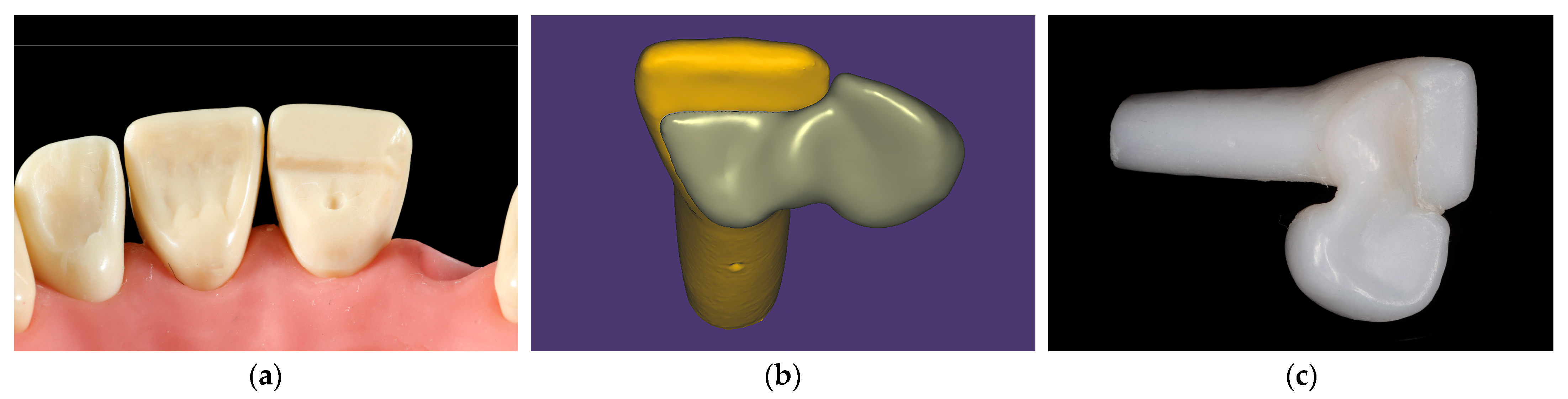 Materials Free FullText Bonding Performance of SurfaceTreated Zirconia Cantilevered Resin