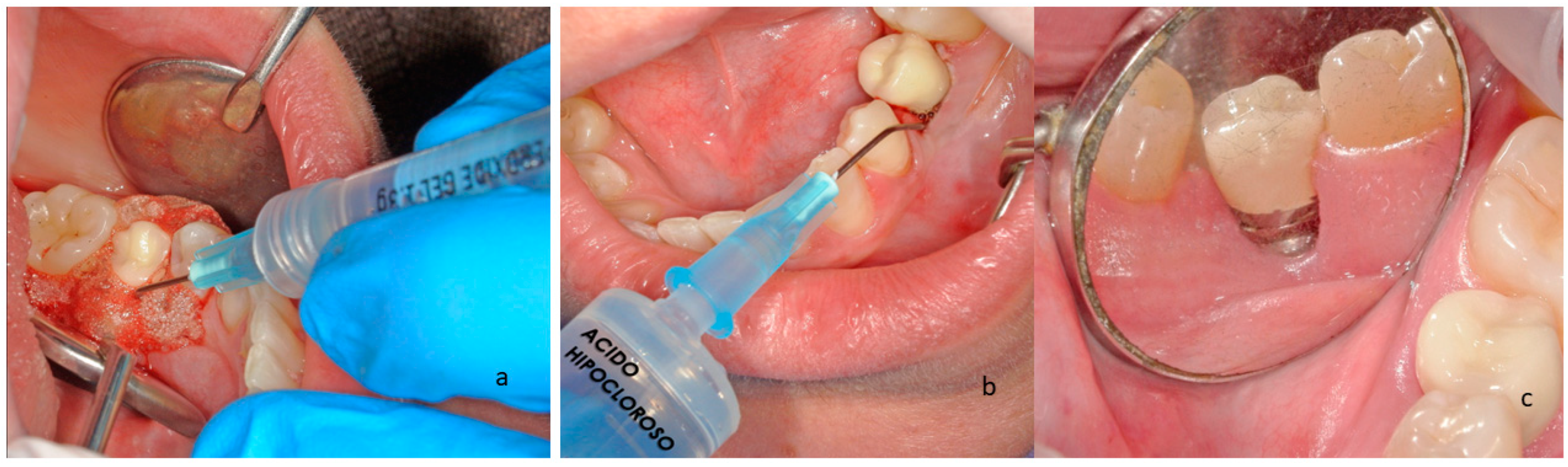 Materials 16 02953 g002