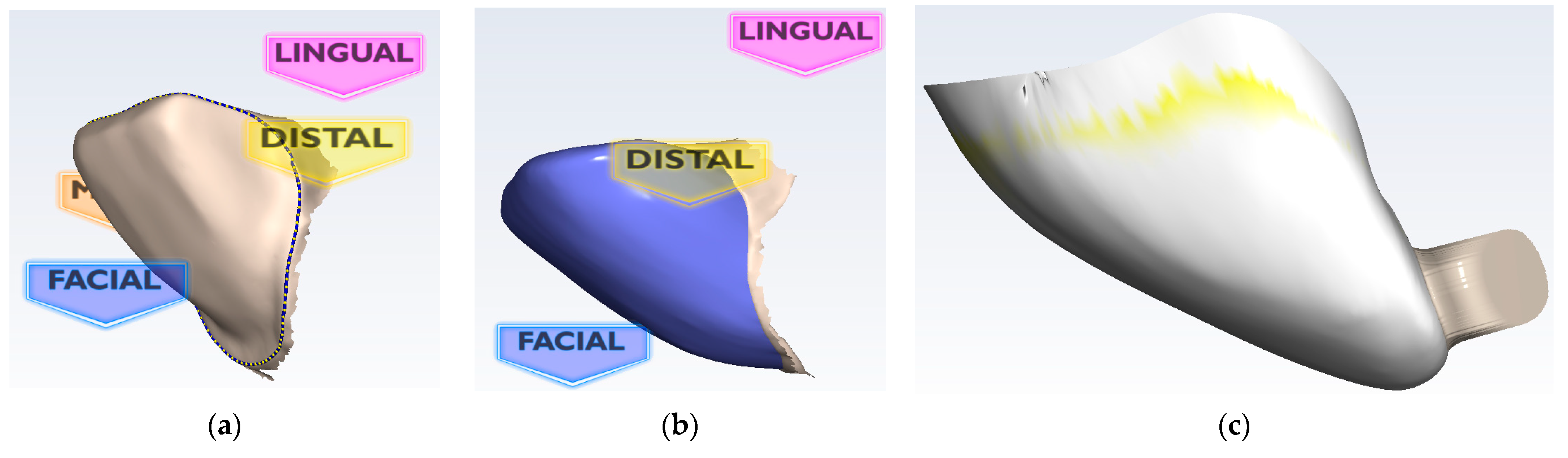 Materials 16 03694 g002
