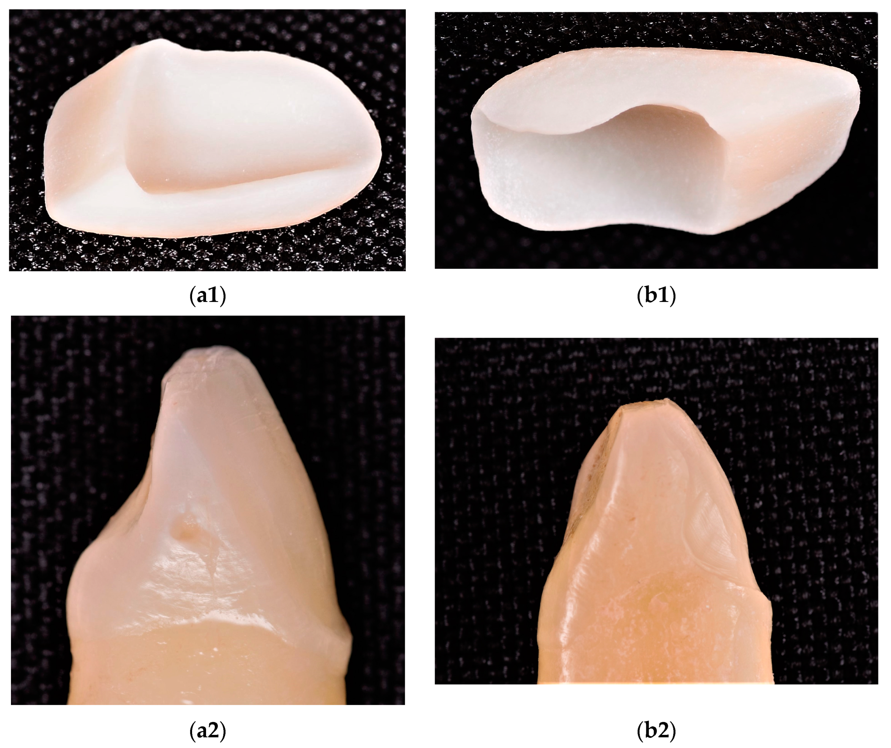 Materials 16 03694 g003