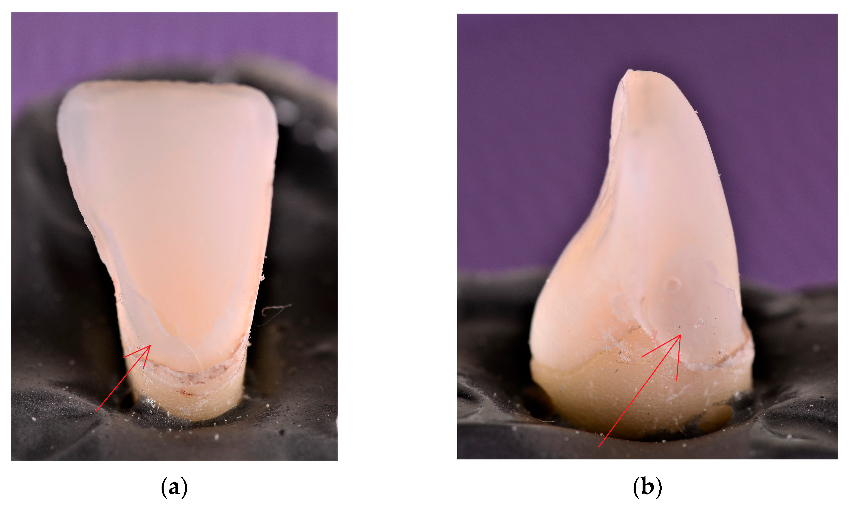 Materials 16 03694 g009