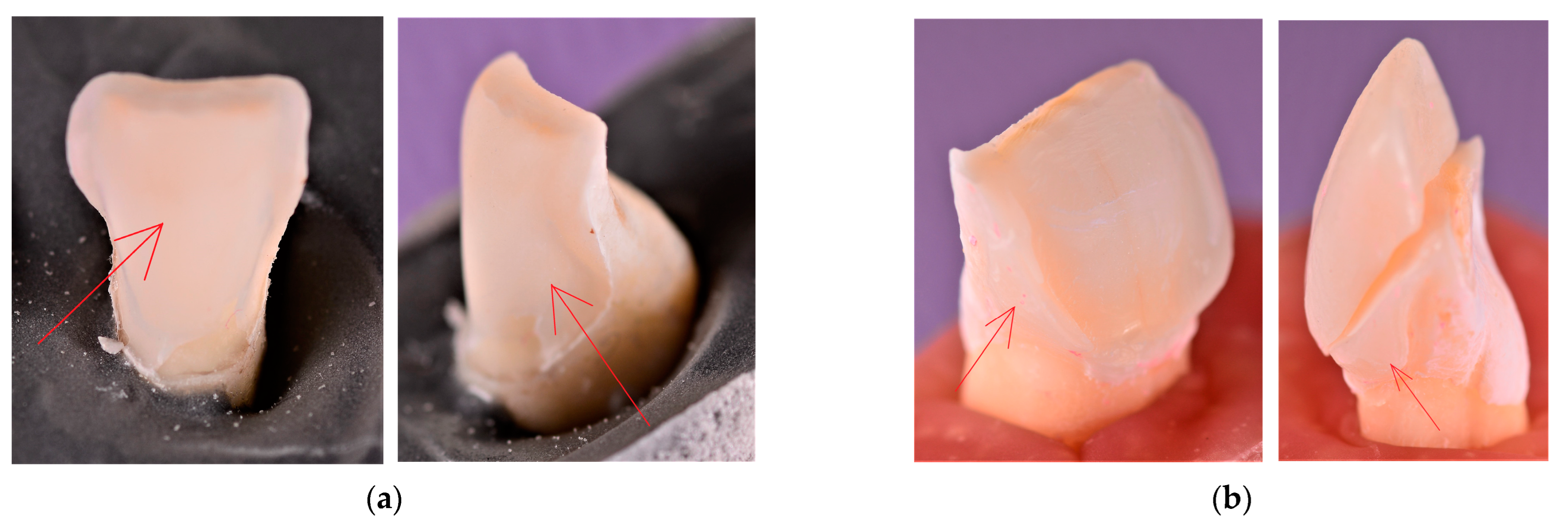 Materials 16 03694 g010