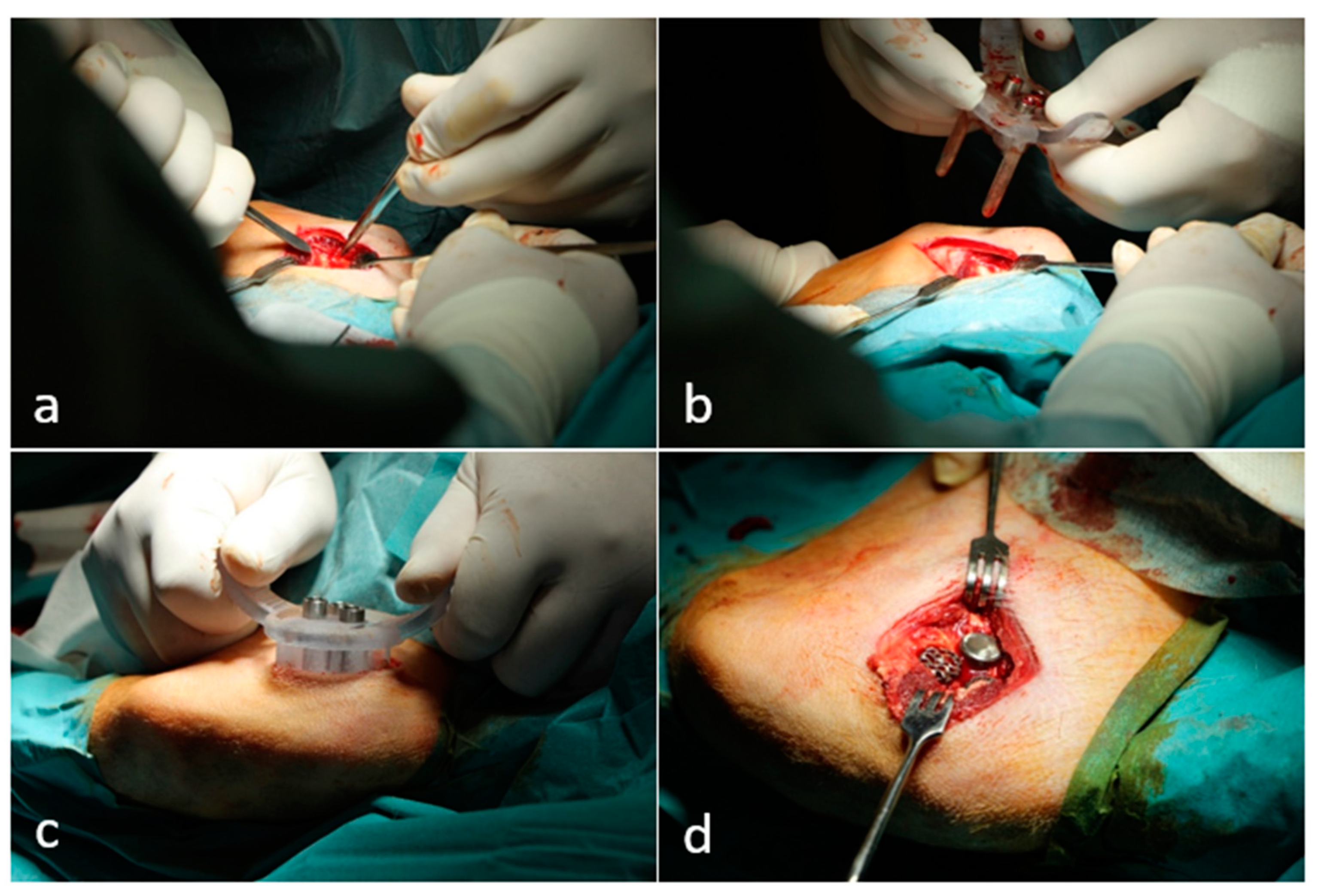 Materials 16 03861 g003 Materials 16 03861 g003