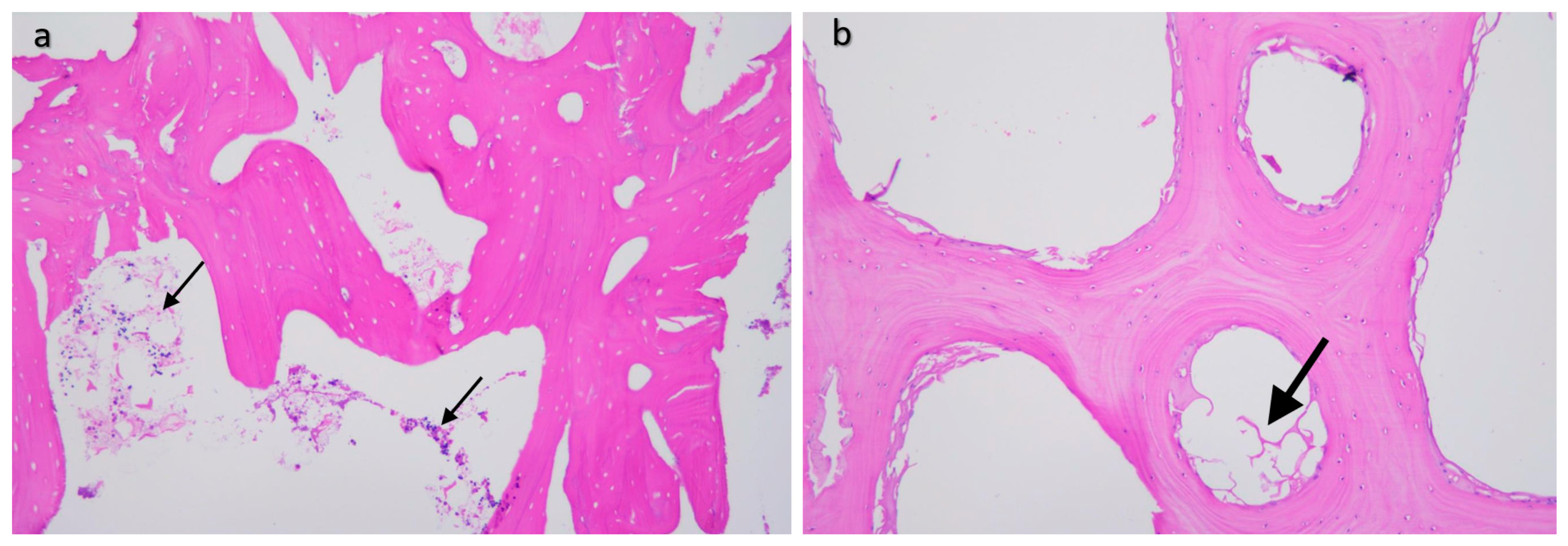 Materials 16 03861 g011 Materials 16 03861 g011
