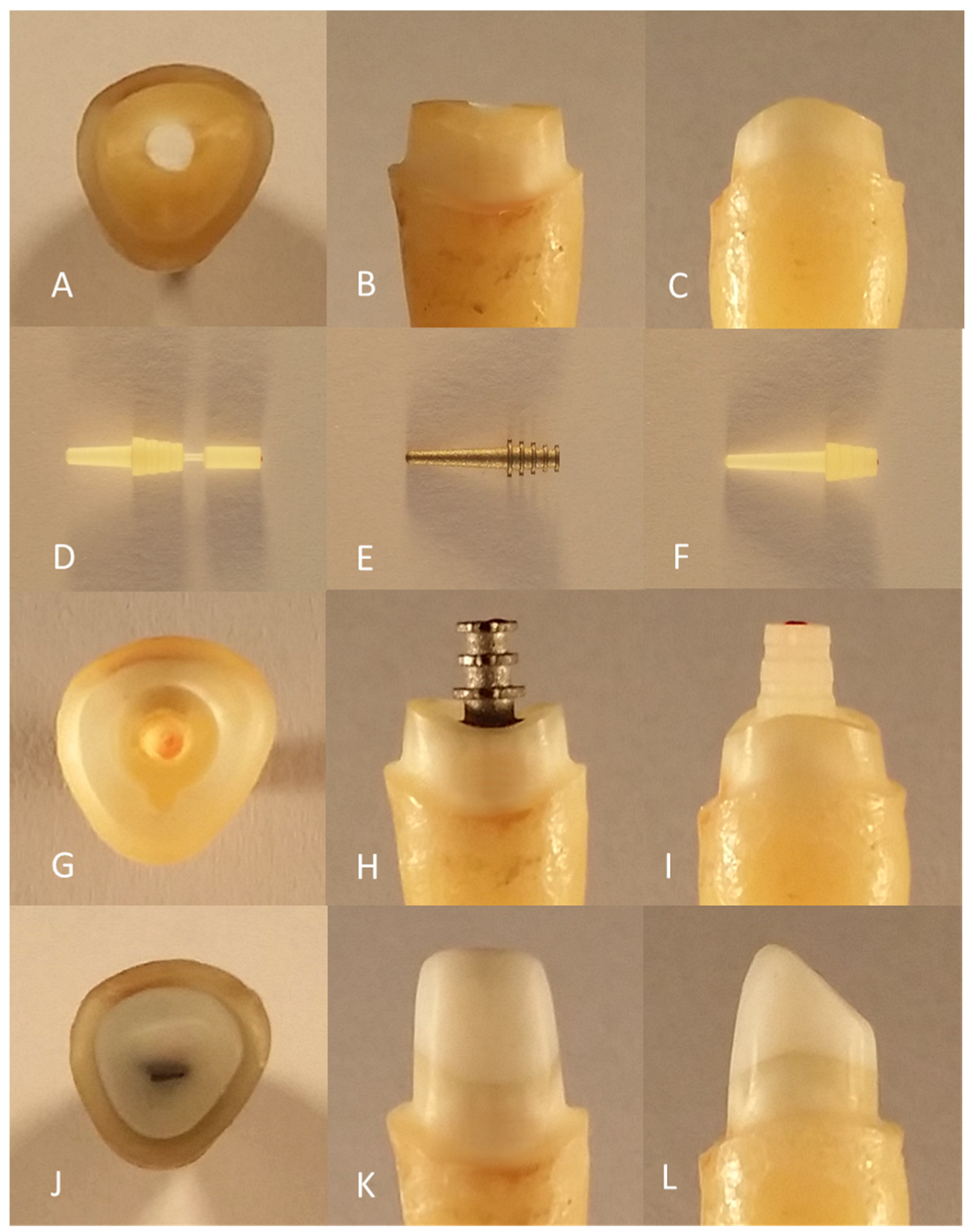 Materials 16 03985 g001