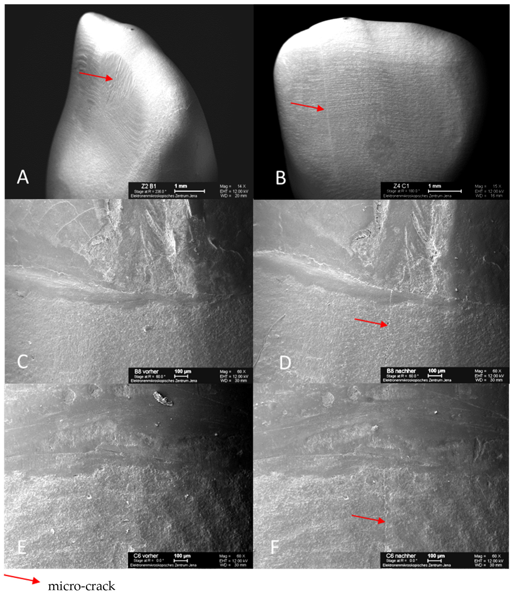Materials 16 03985 g008