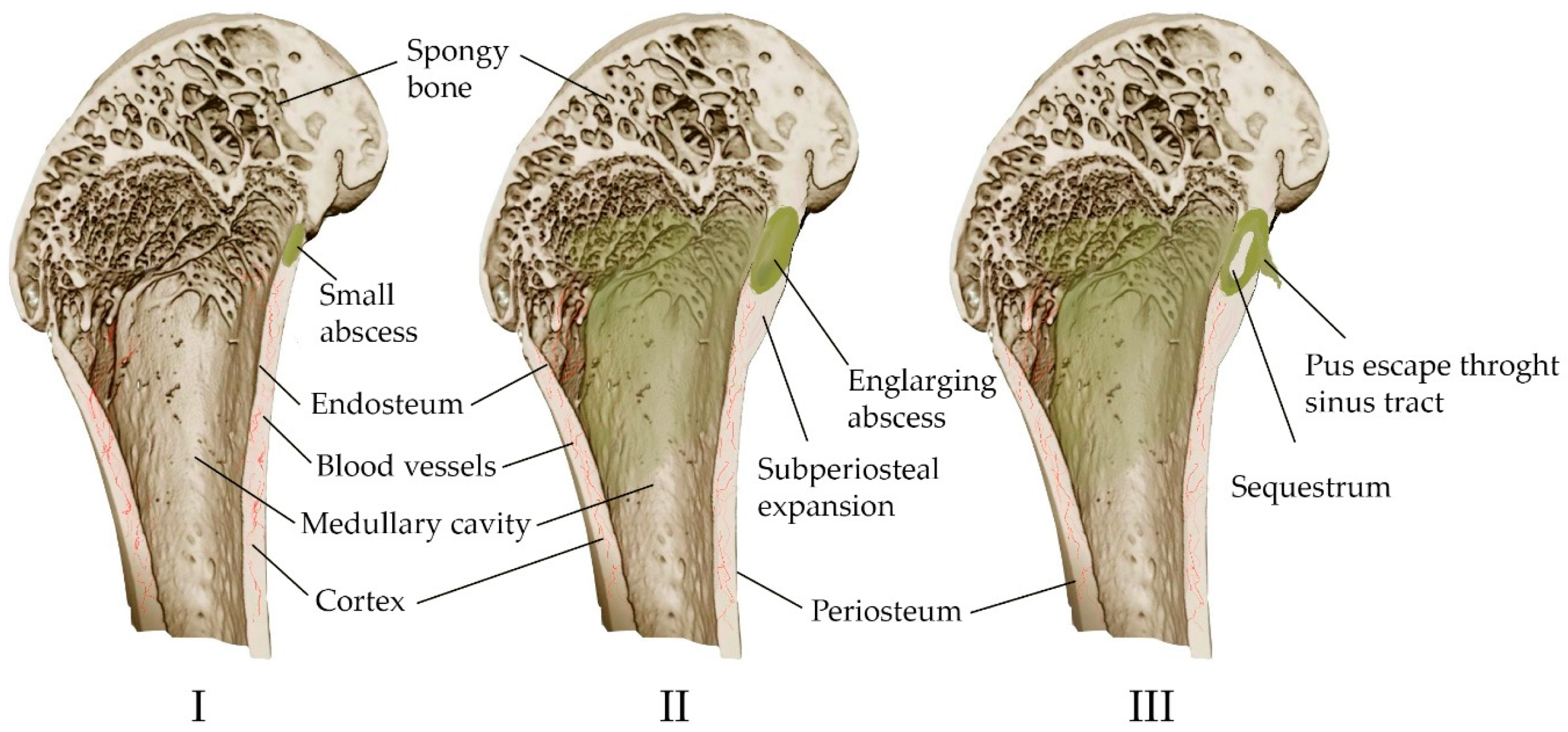 Materials 16 04017 g002 Materials 16 04017 g002