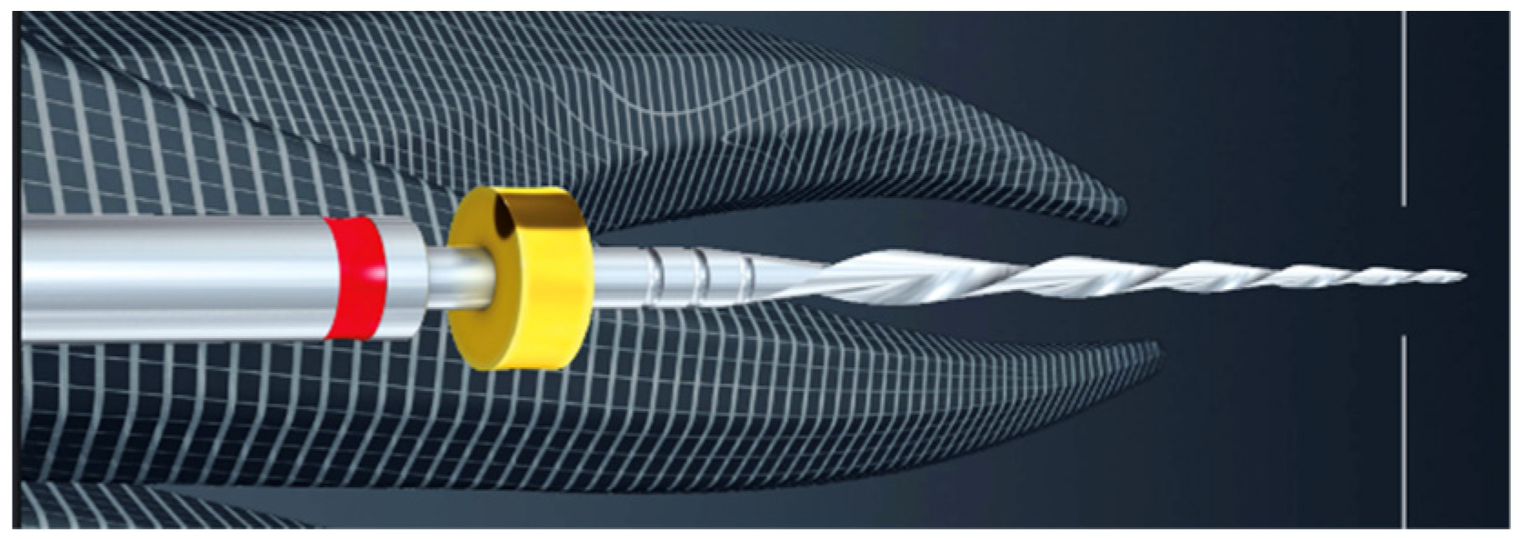 Materials 16 04089 g001 Materials 16 04089 g001