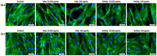 Biological Response of Human Gingival Fibroblasts to Zinc-Doped ...
