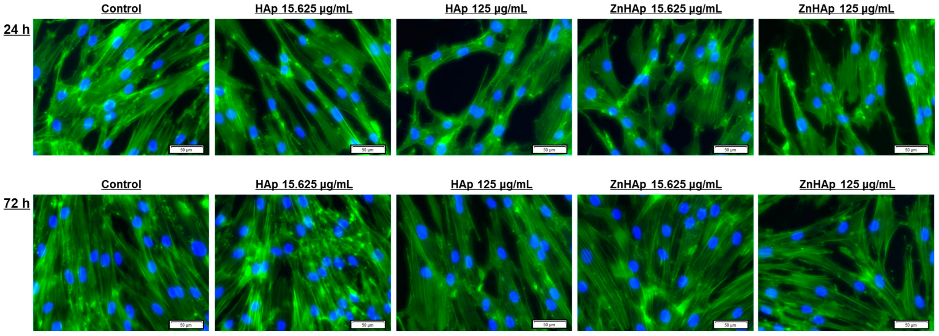 Materials 16 04145 g007
