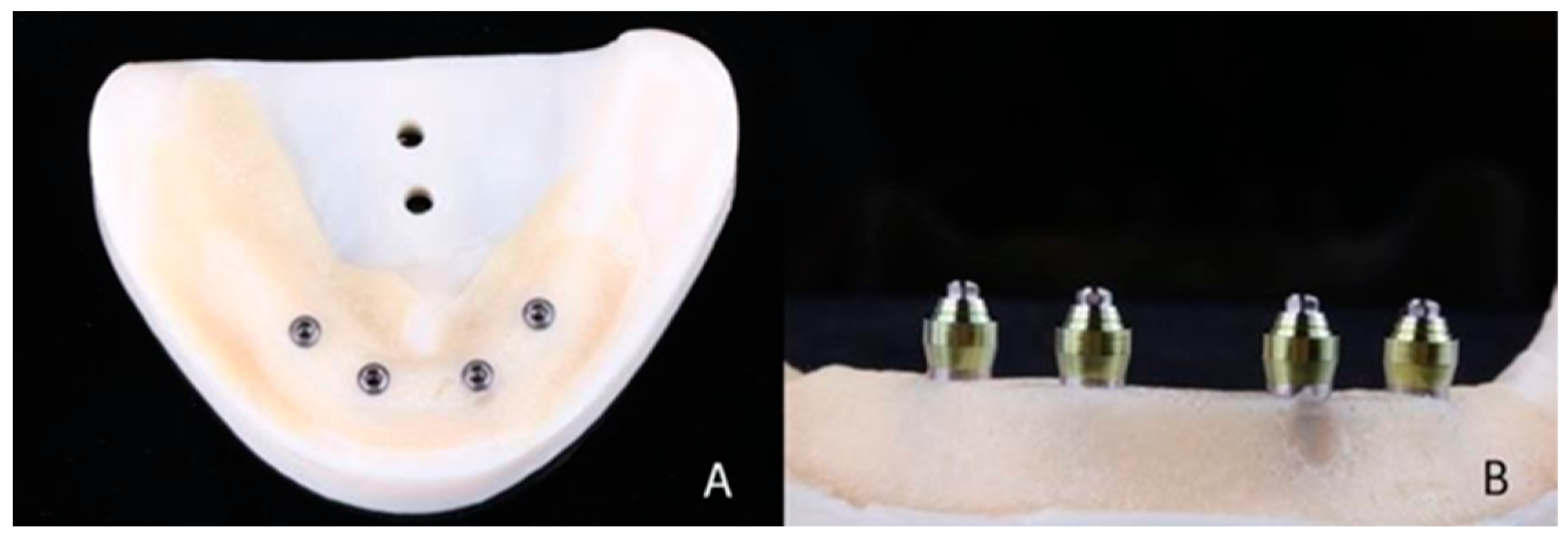 Materials 16 04176 g001 Materials 16 04176 g001