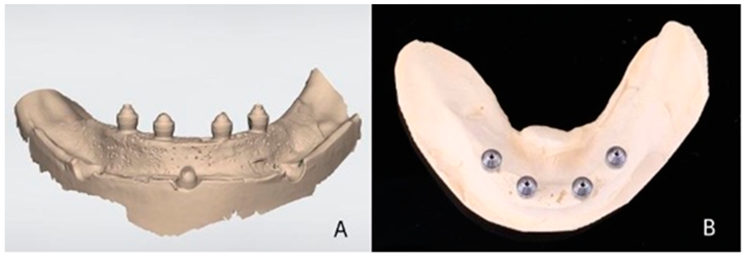 Materials 16 04176 g003 Materials 16 04176 g003