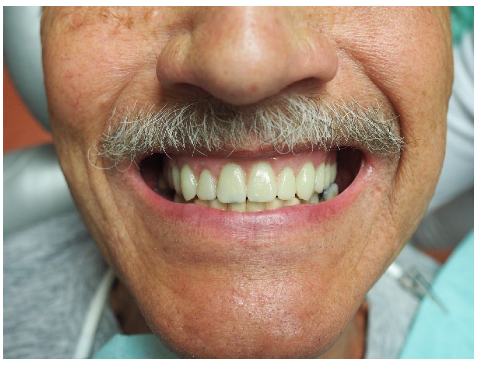 Materials 16 05248 g001