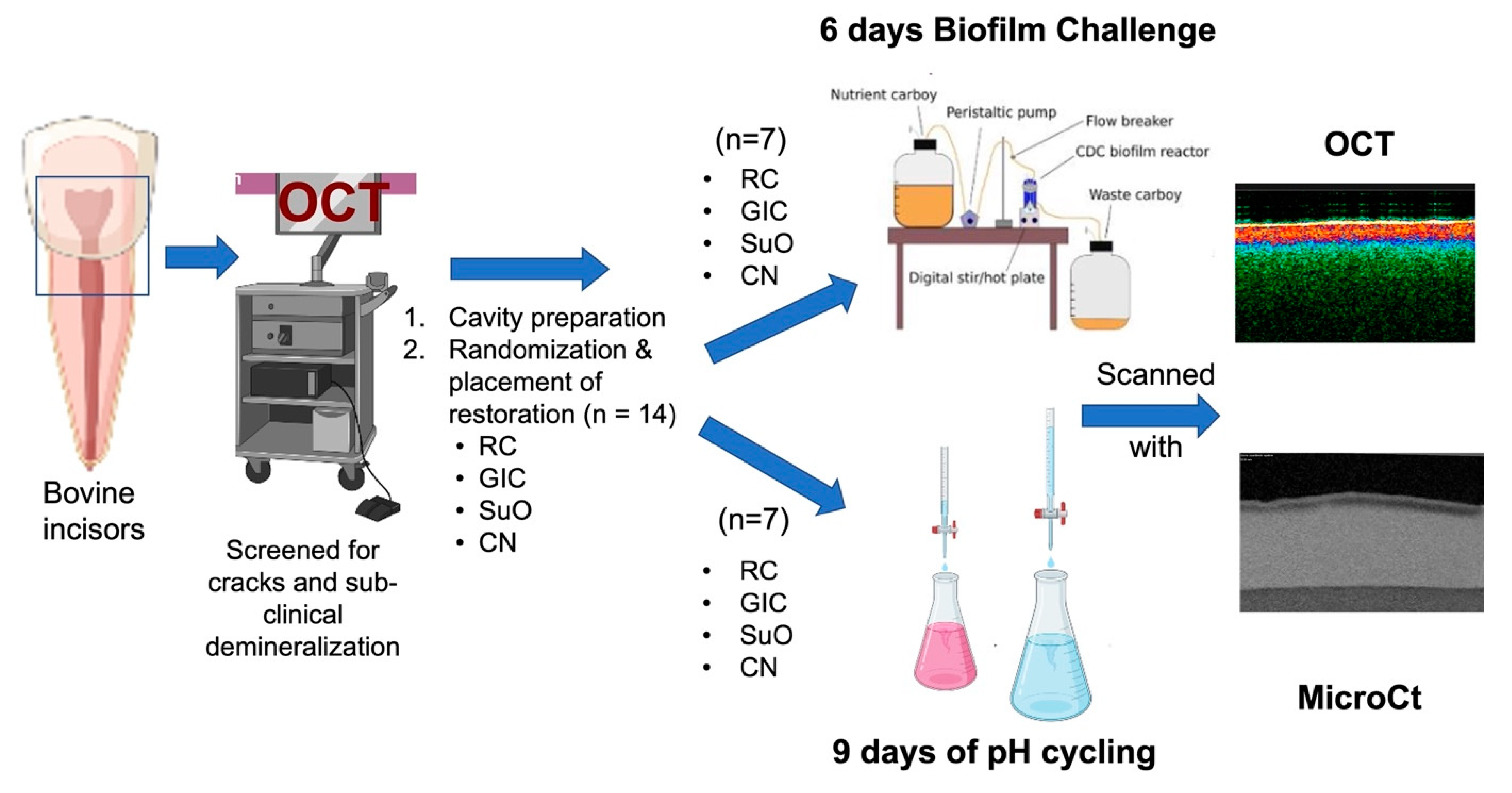 Inhibition of Caries around Restoration by Ion-Releasing 