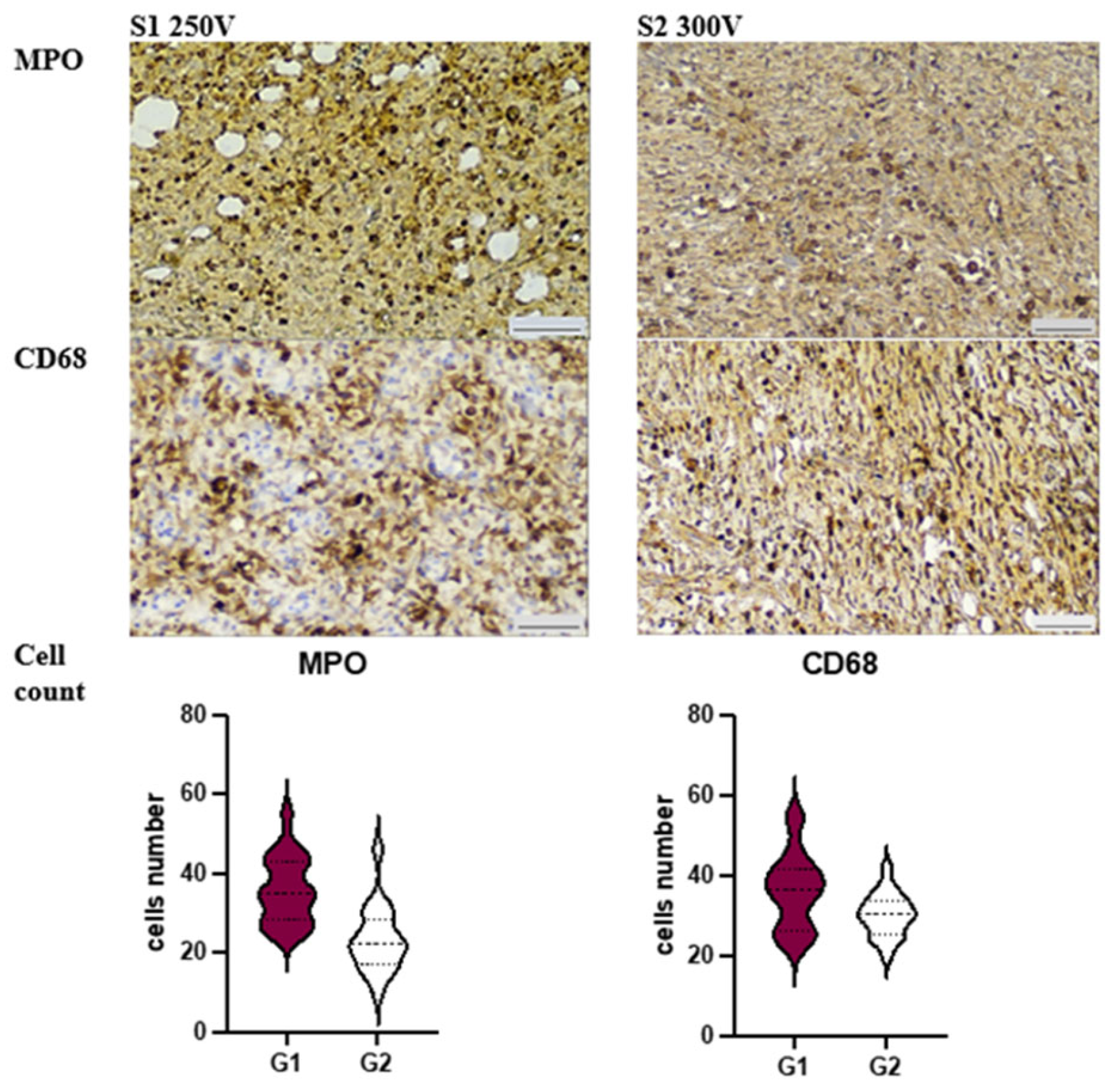 Materials 16 05807 g004