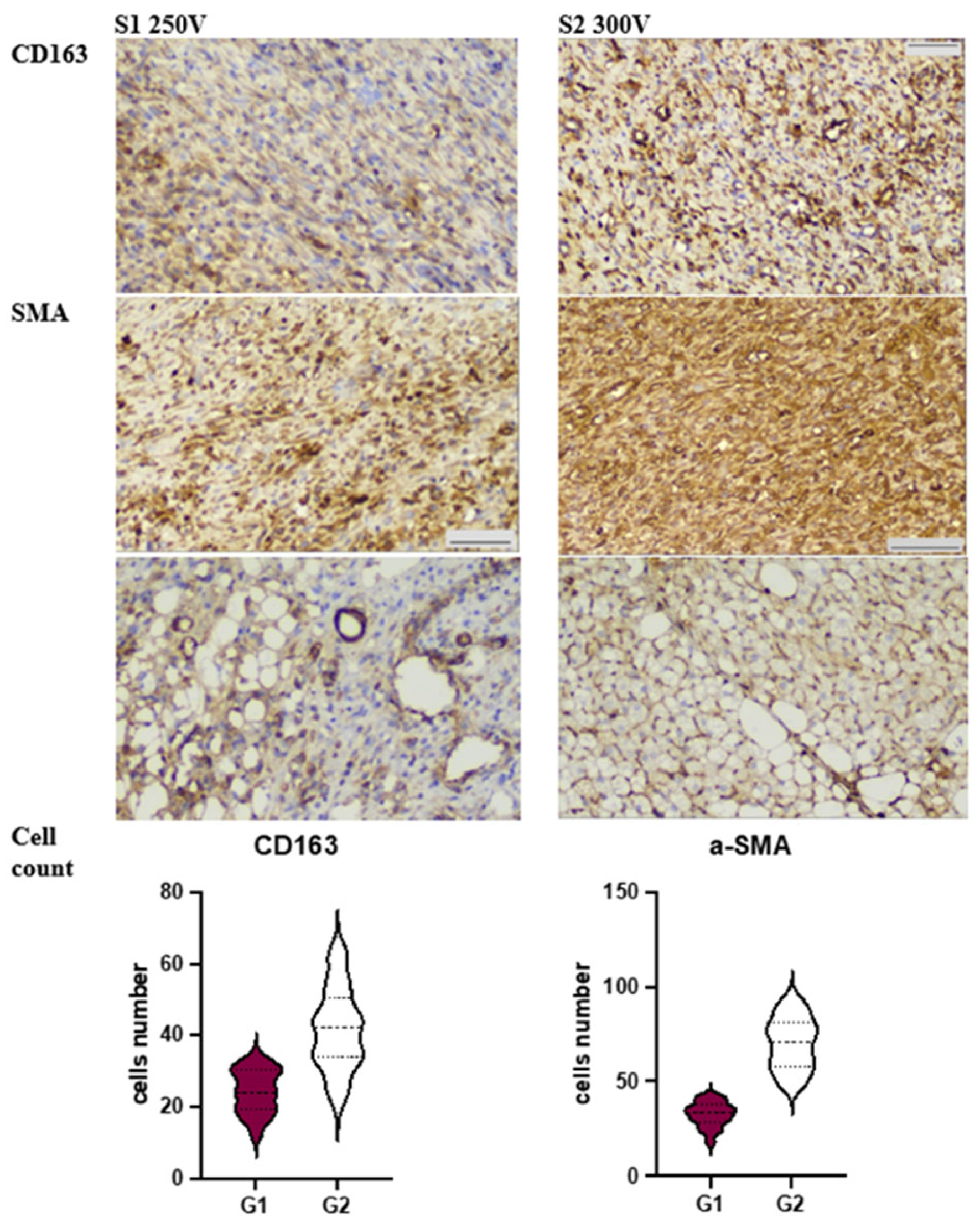 Materials 16 05807 g005