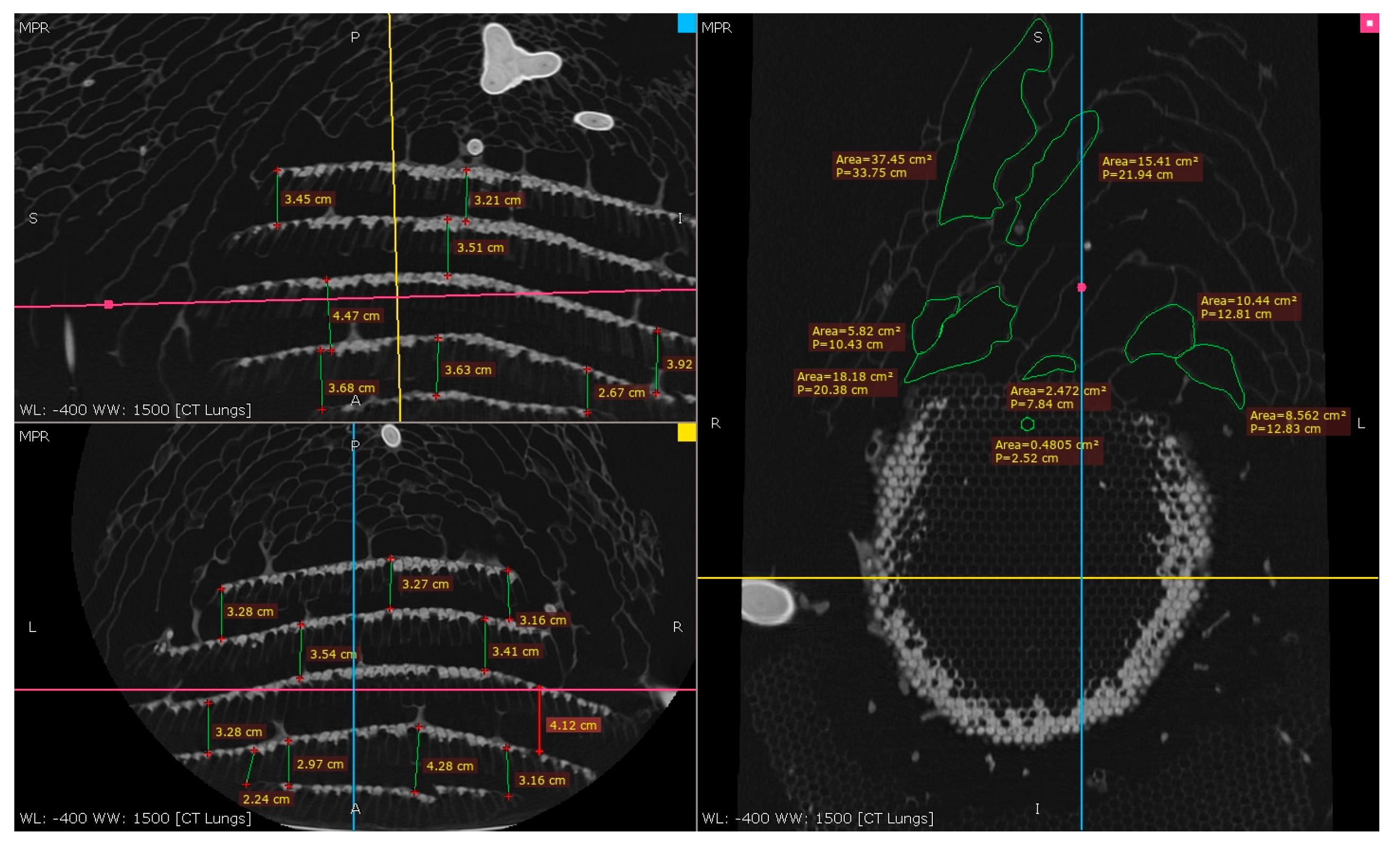 Materials 16 07027 g008a