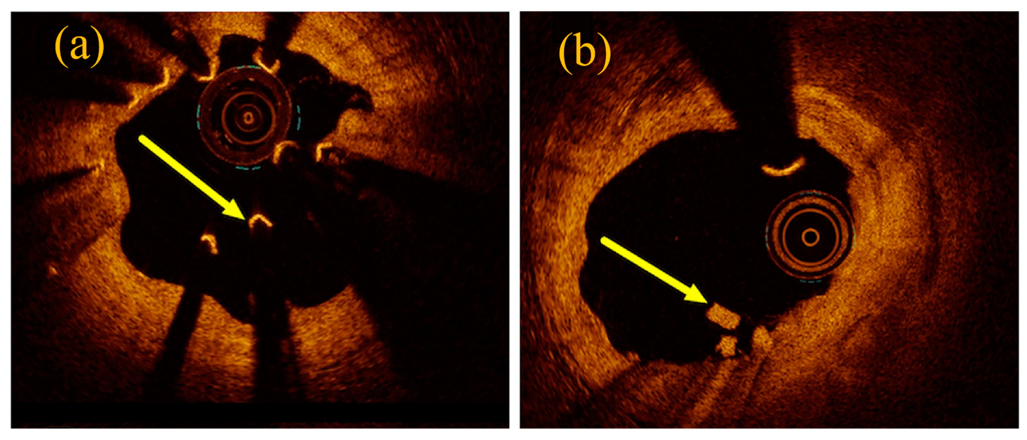 Materials 17 00068 g004