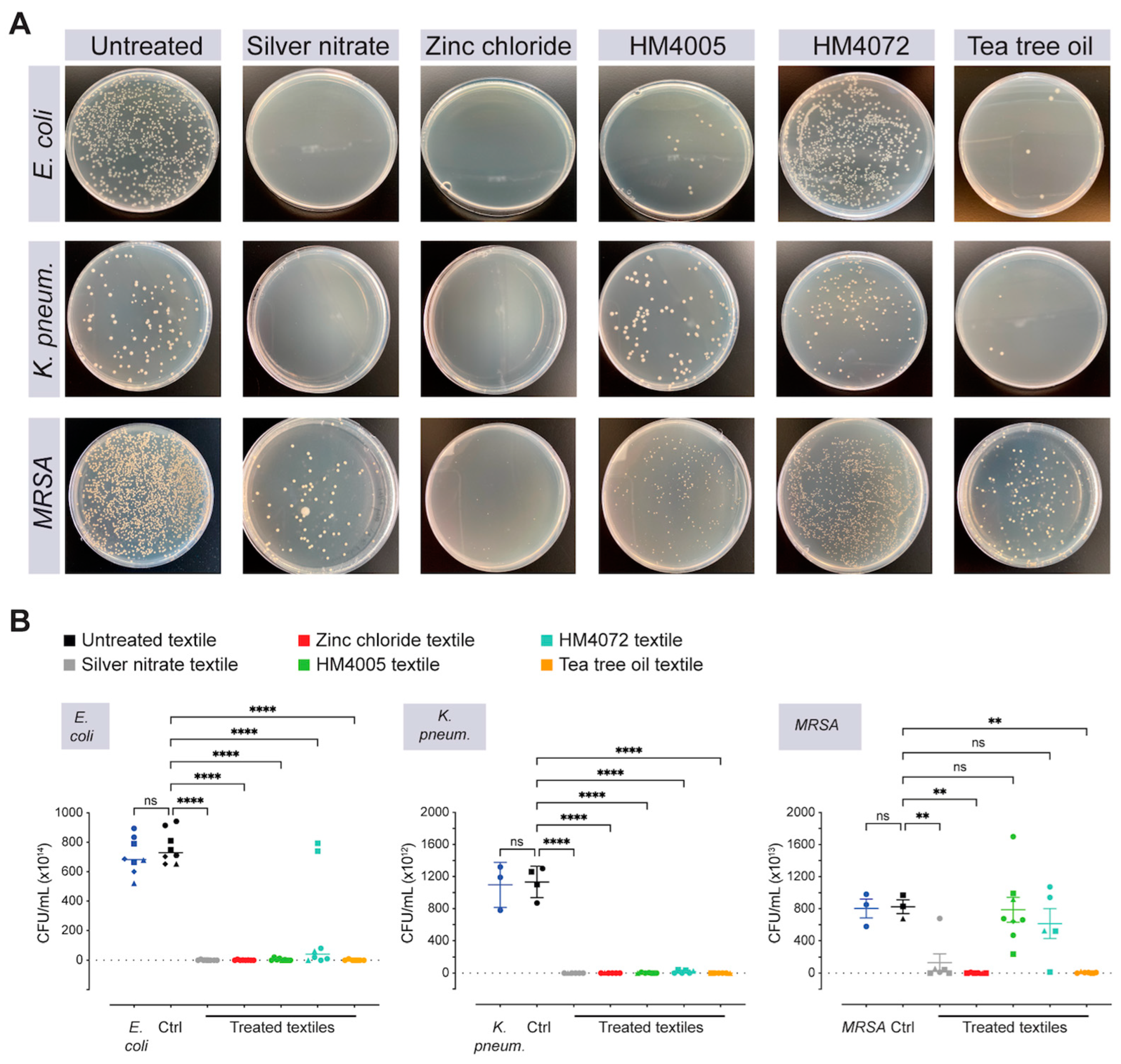 Materials 17 00383 g004a