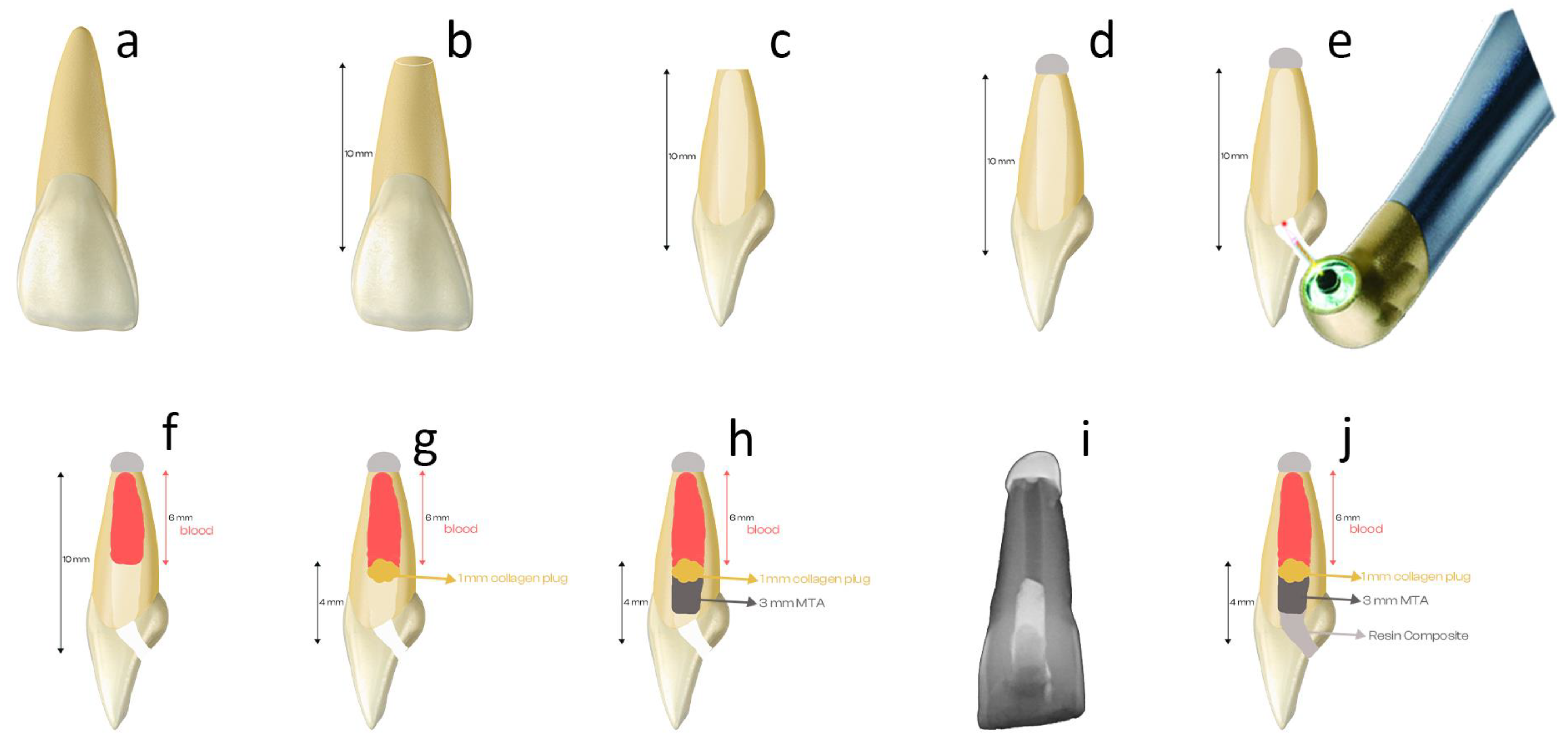 Materials 17 01015 g001
