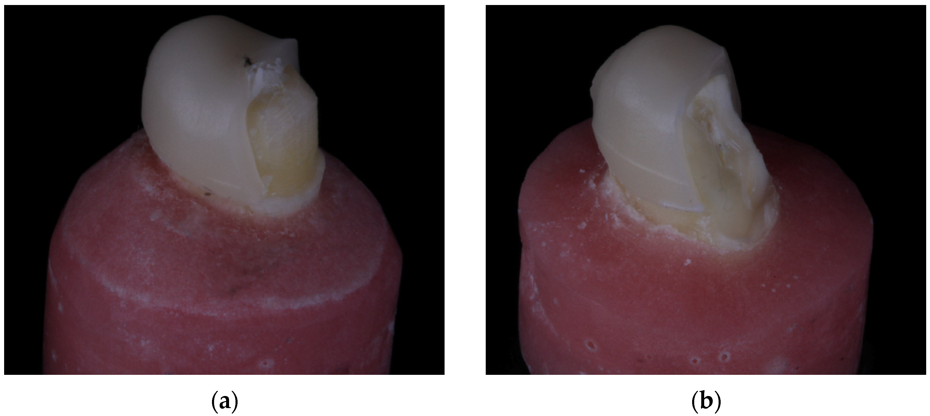 Materials 17 01096 g005