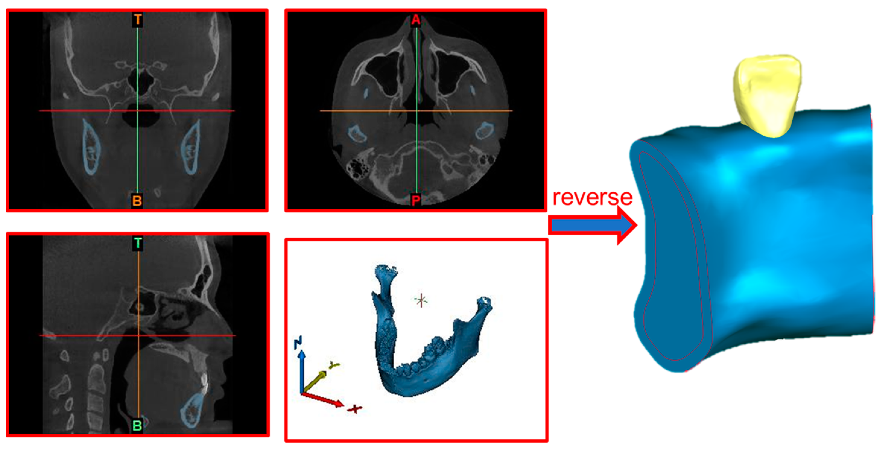 Materials 17 01137 g002