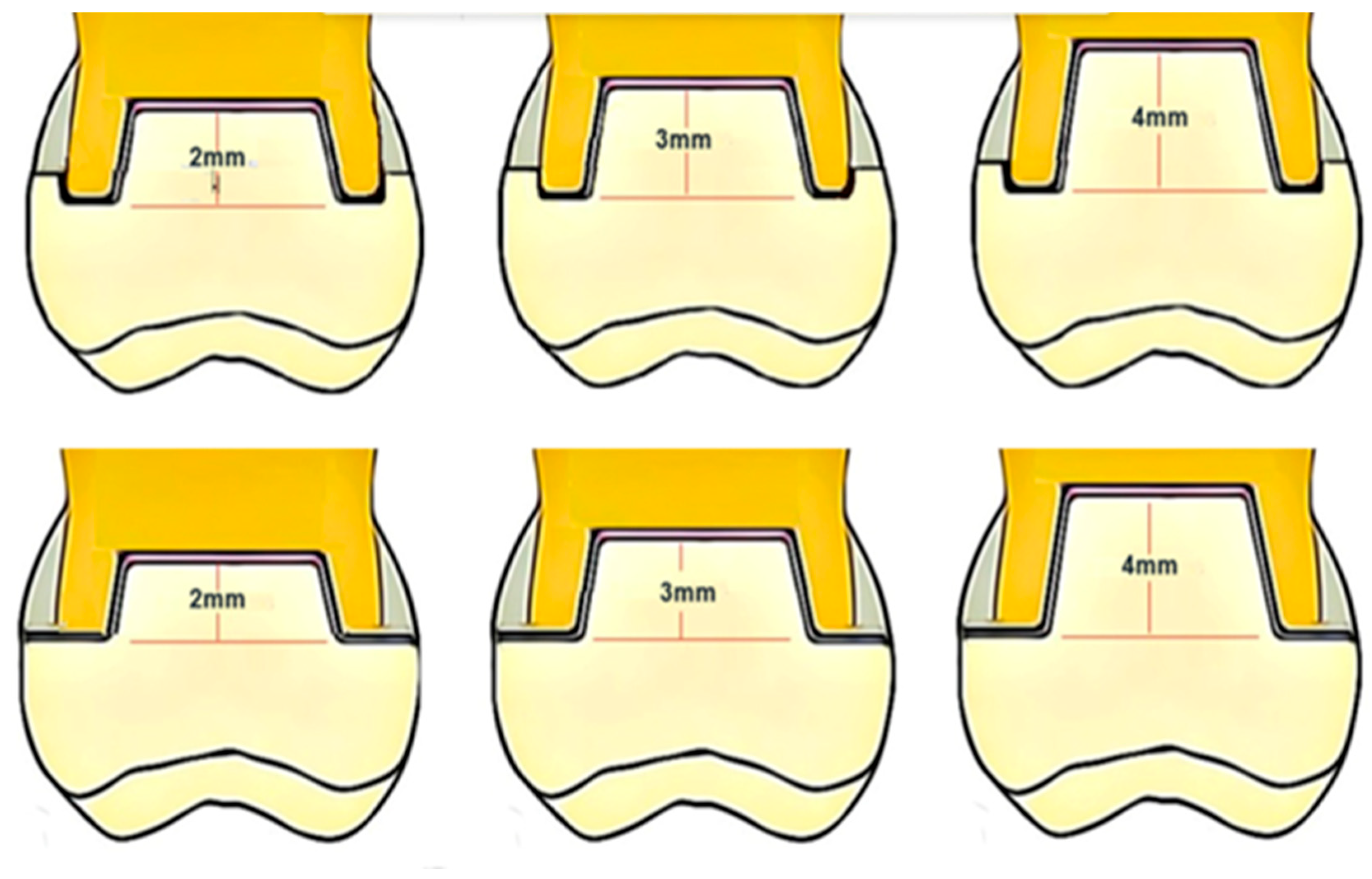 Materials 17 01411 g001