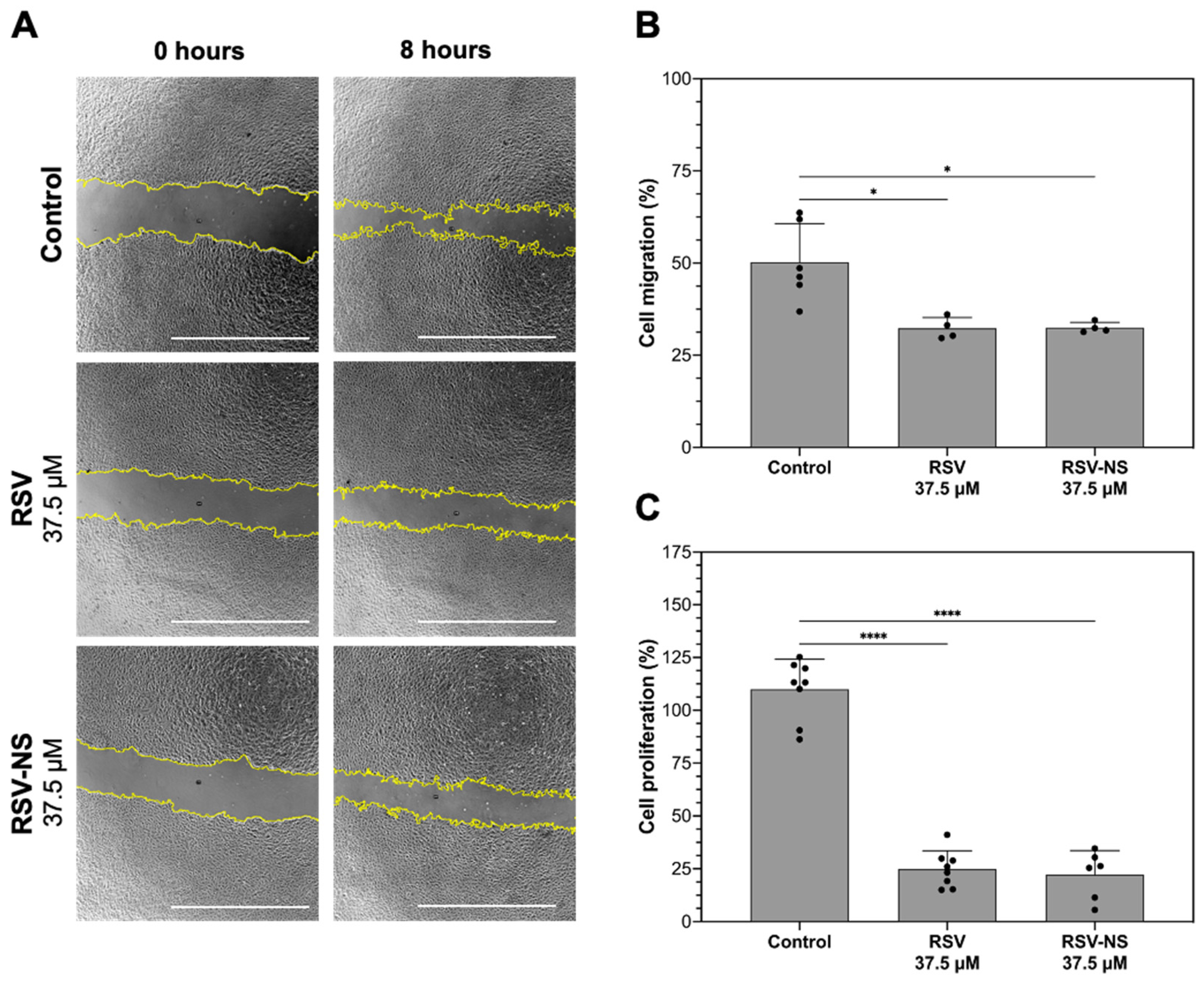 Materials 17 01420 g004