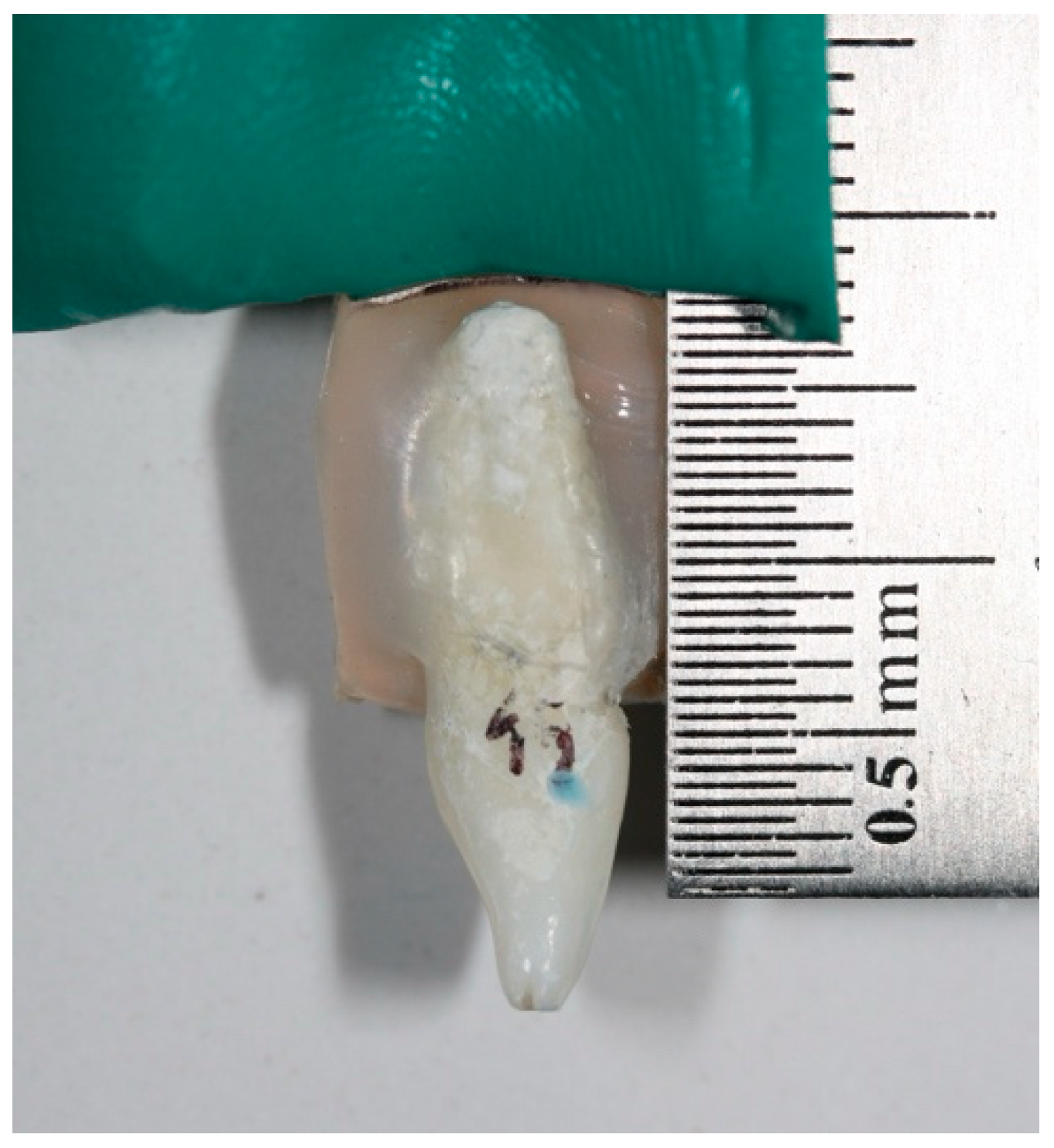 Materials 17 01519 g001