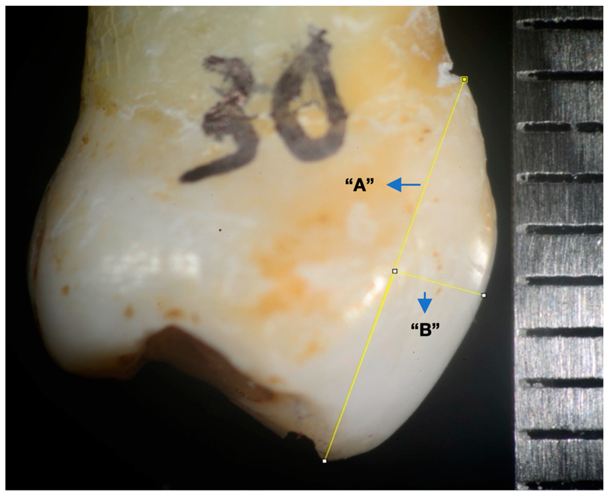 Materials 17 01519 g004