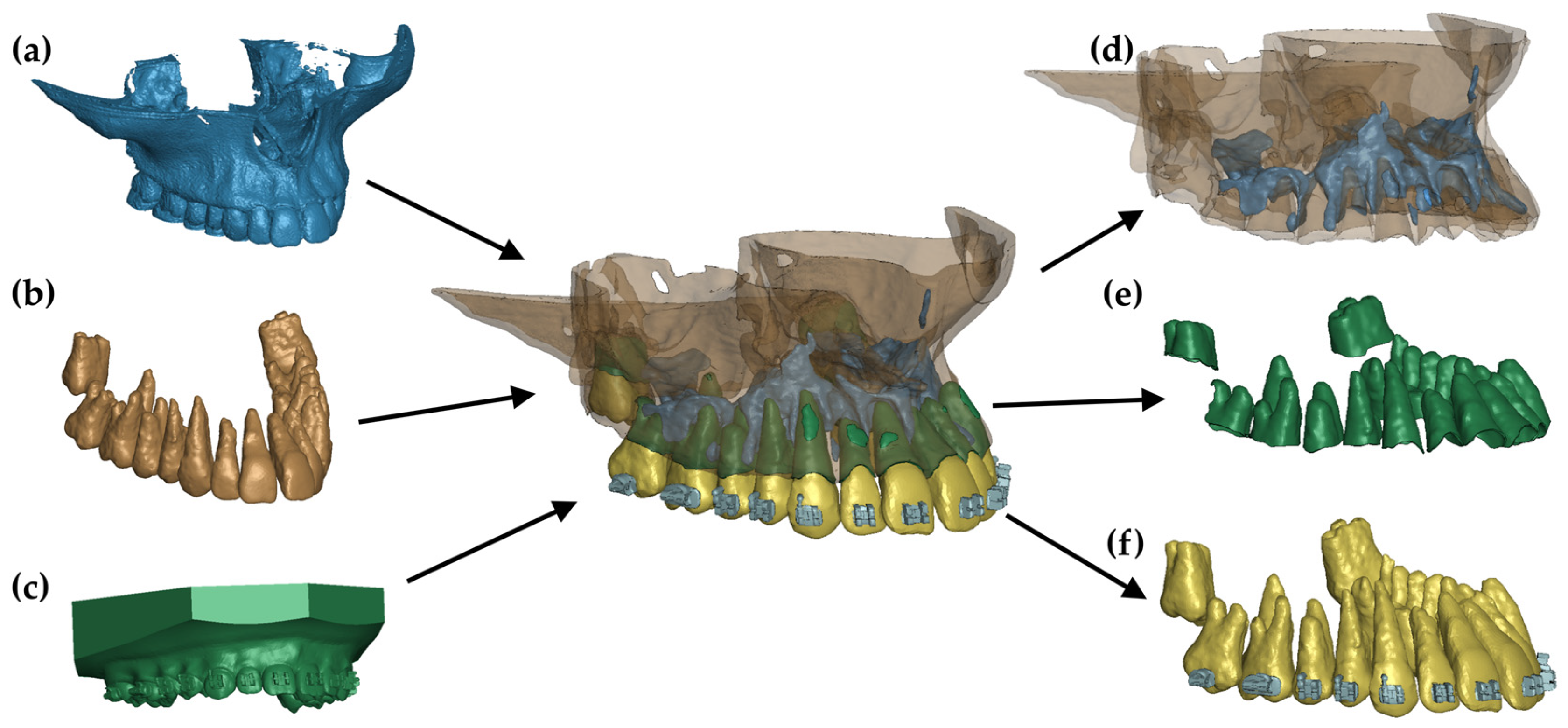 Materials 17 01661 g001