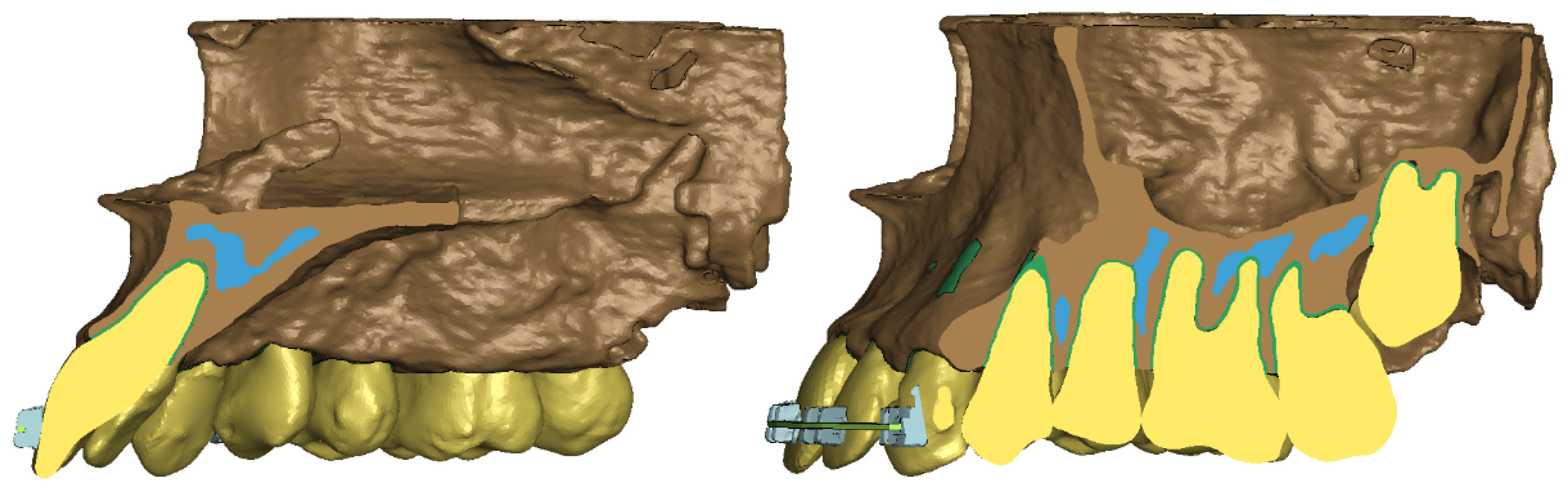 Materials 17 01661 g002