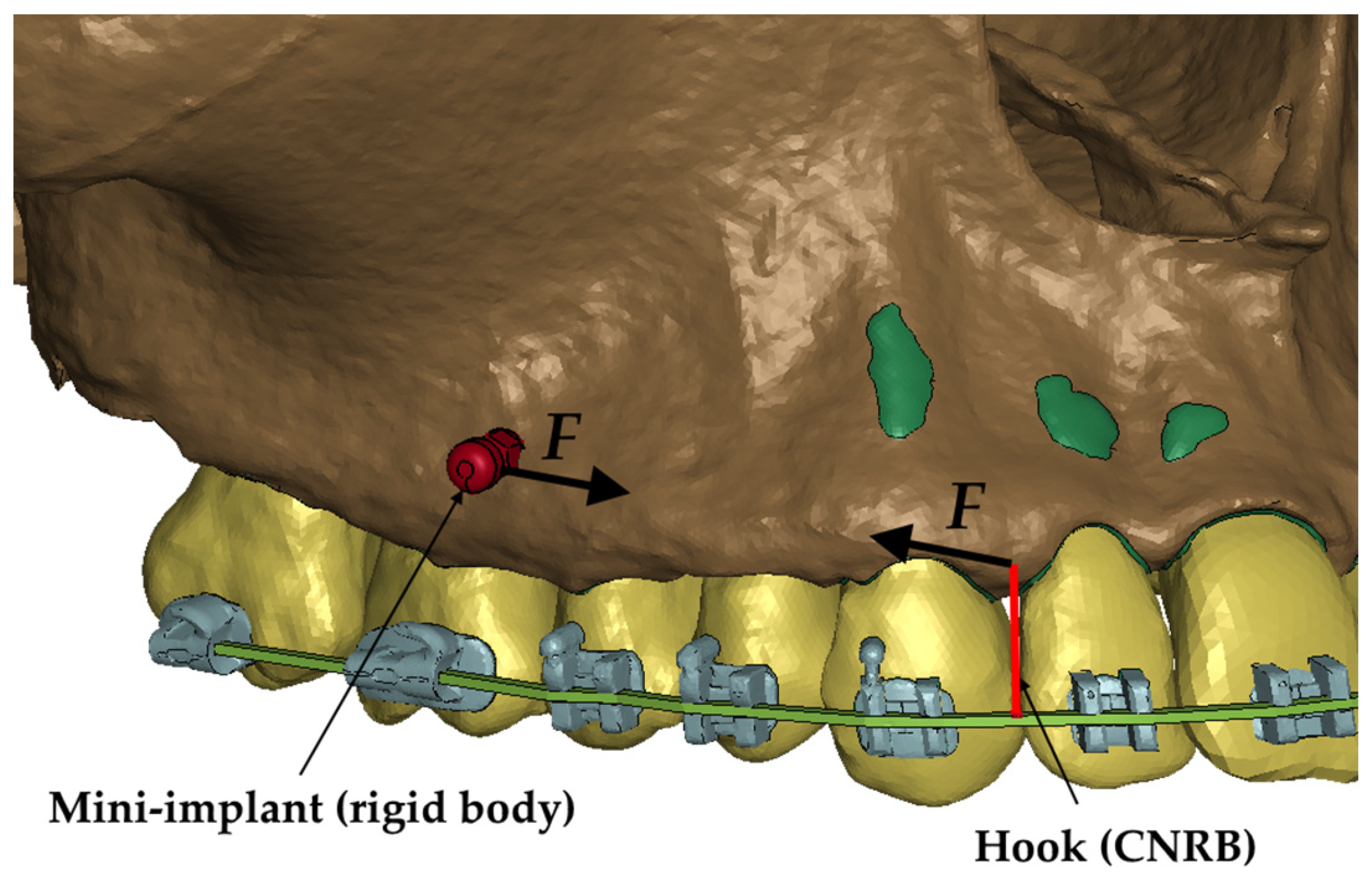 Materials 17 01661 g003