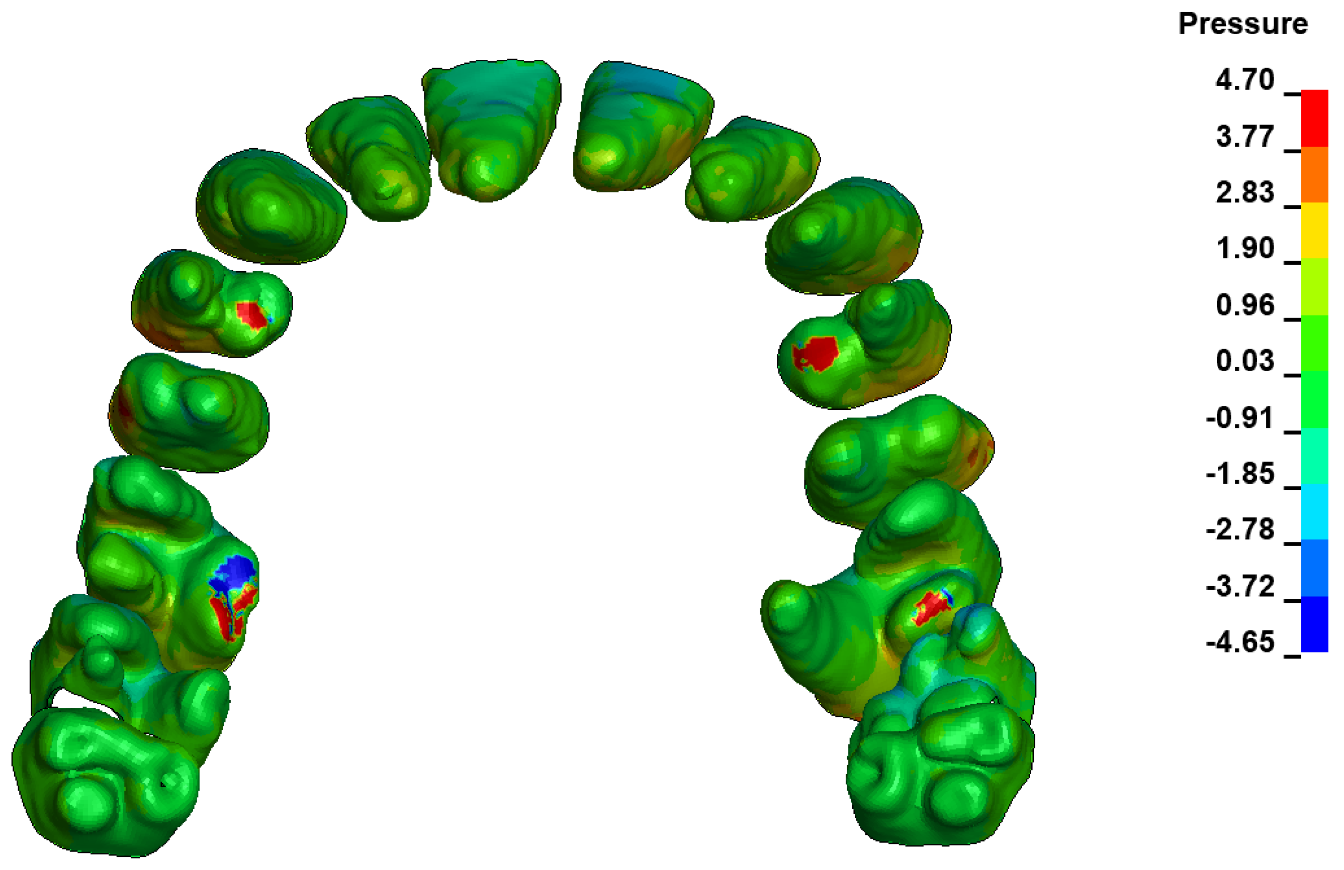 Materials 17 01661 g006