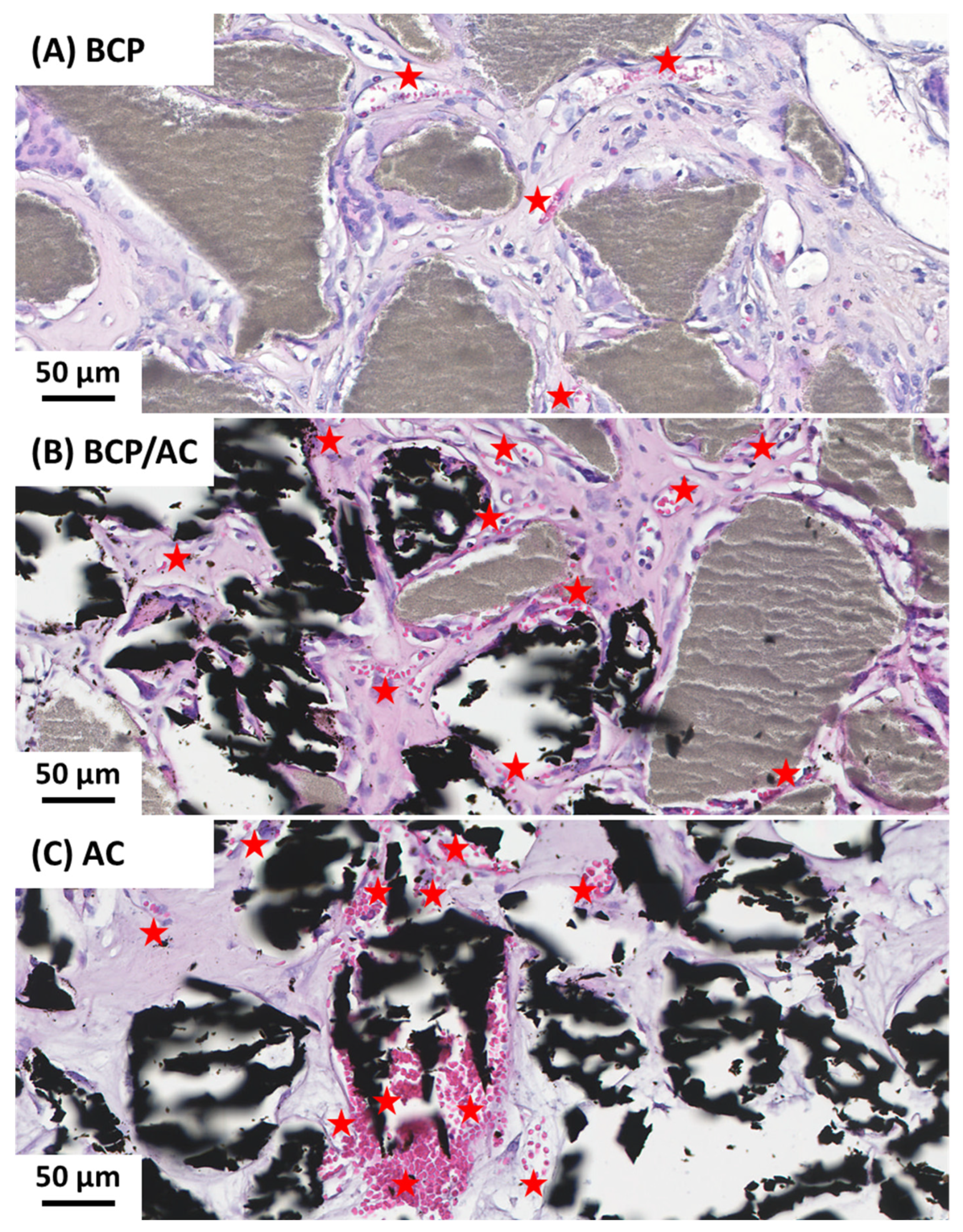 Materials 17 01749 g004
